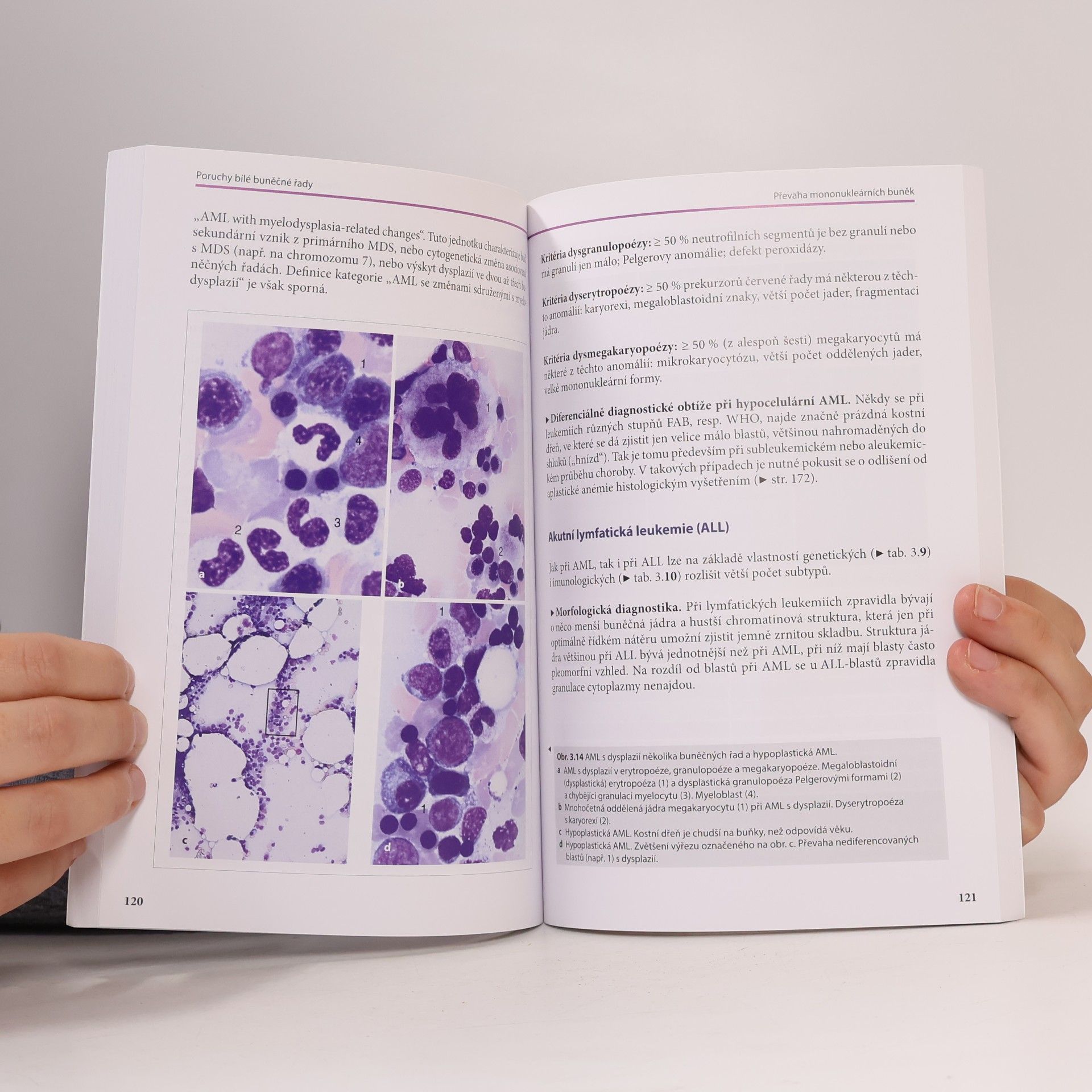 Torsten Haferlach Kapesní atlas hematologie