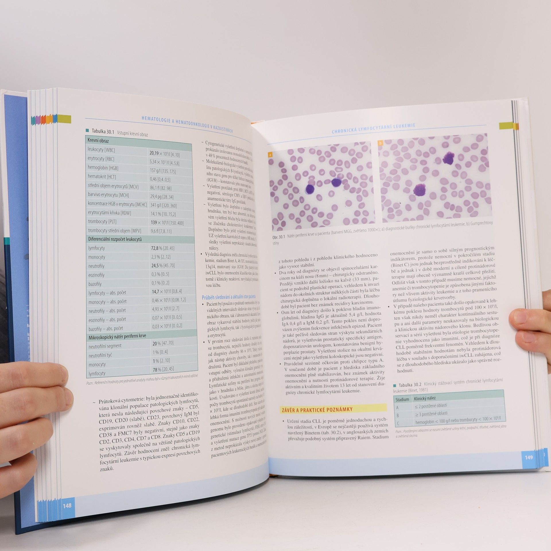 Peter Rohoň Hematologie a hematoonkologie v kazuistikách