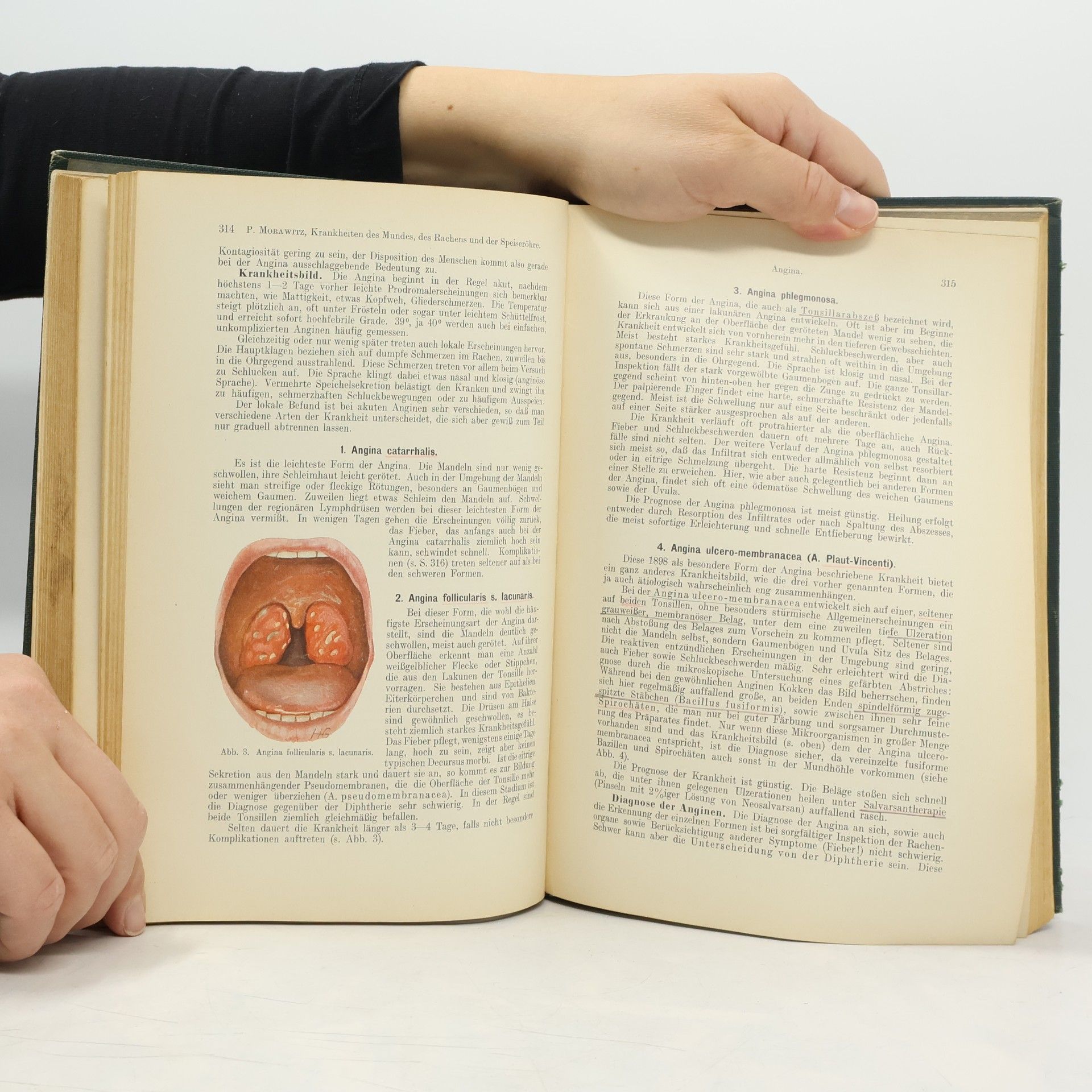 J. von Mering J. V. Mering's Lehrbuch der inneren Medizin 1