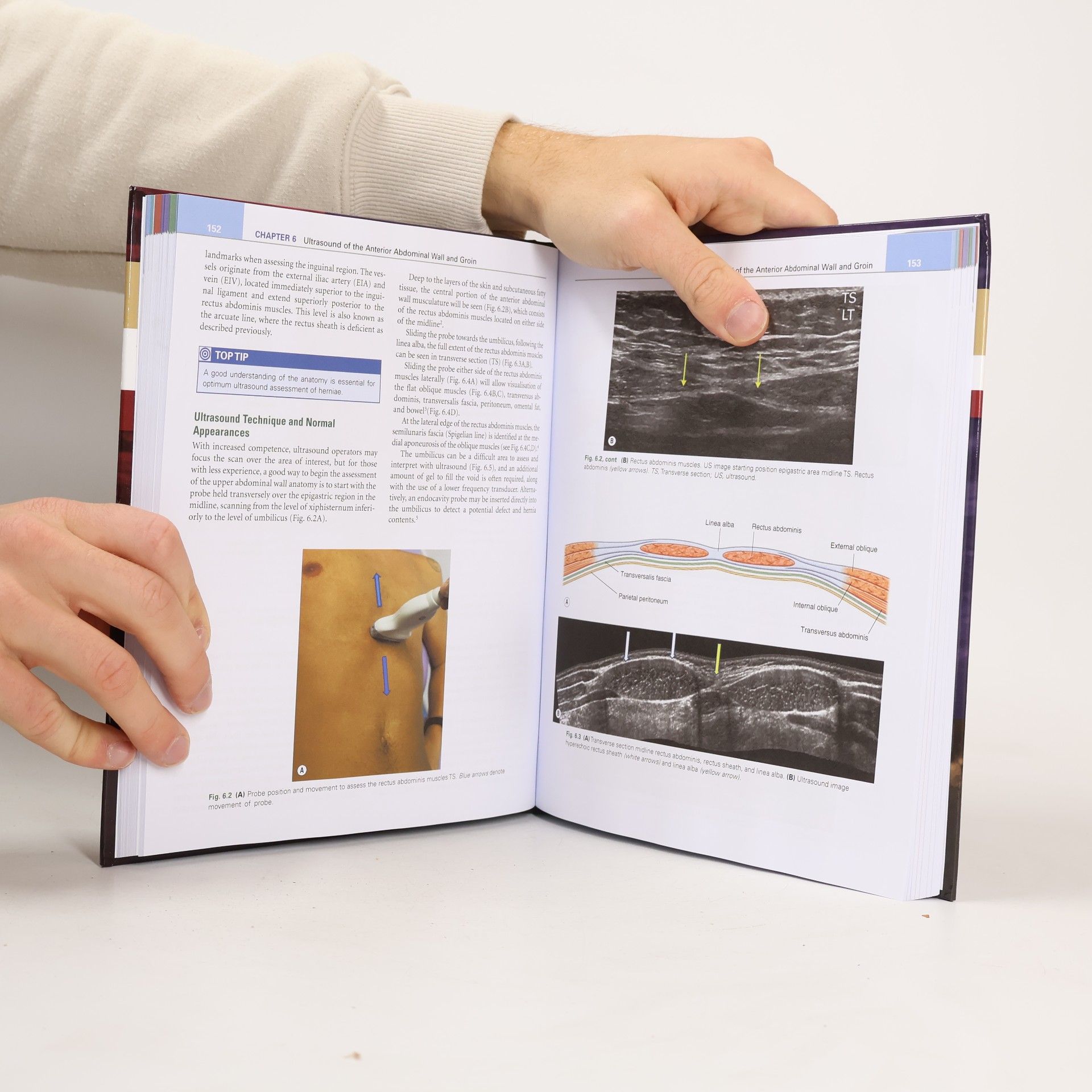 Lorelei Waring DCR (R) PgC AP MSc Medical Ultrasound FHEA Musculoskeletal Ultrasound