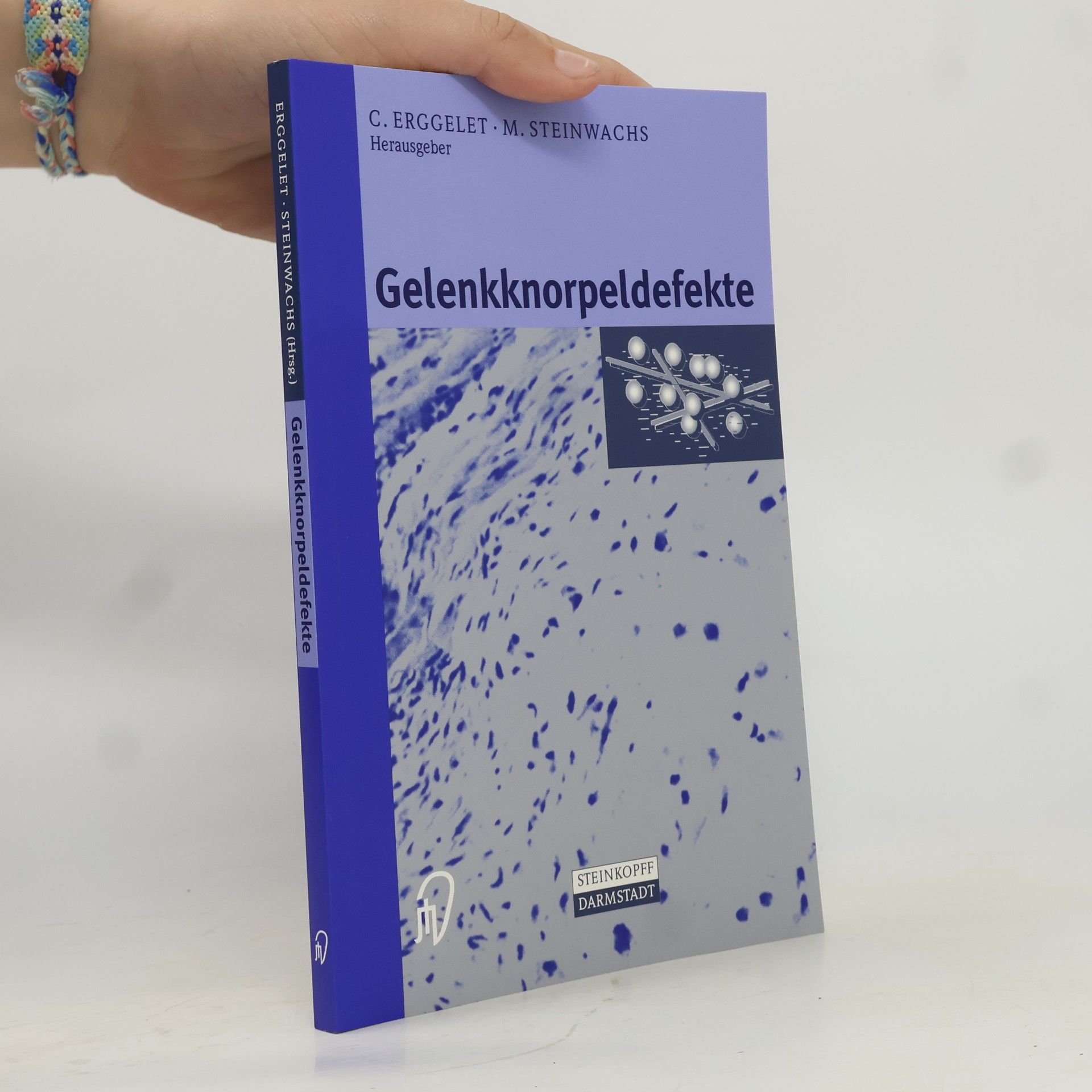 Gelenkknorpeldefekte