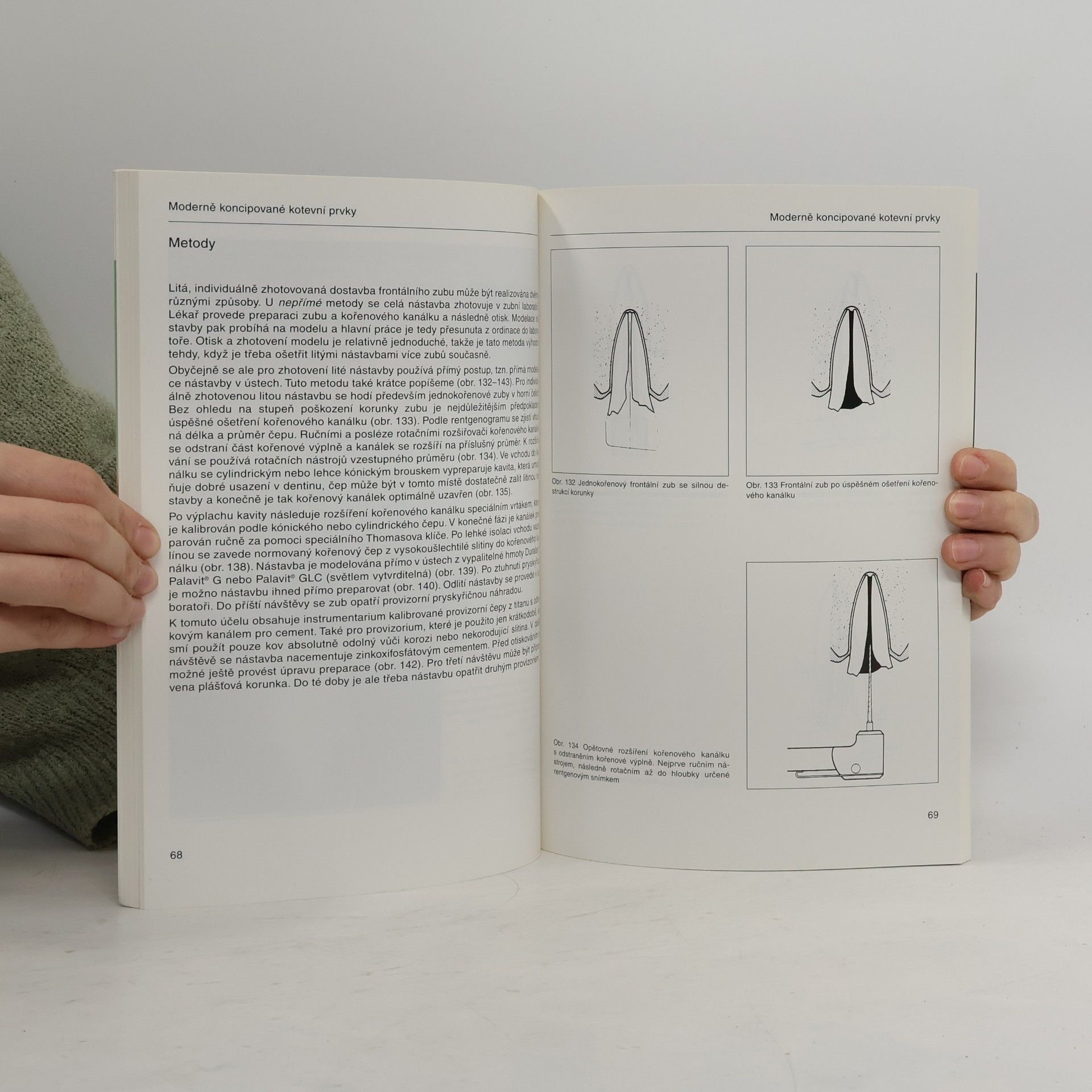 Walter Widmer Quintessenz Bibliothek: Parapulpální a endodontické kotevní prvky