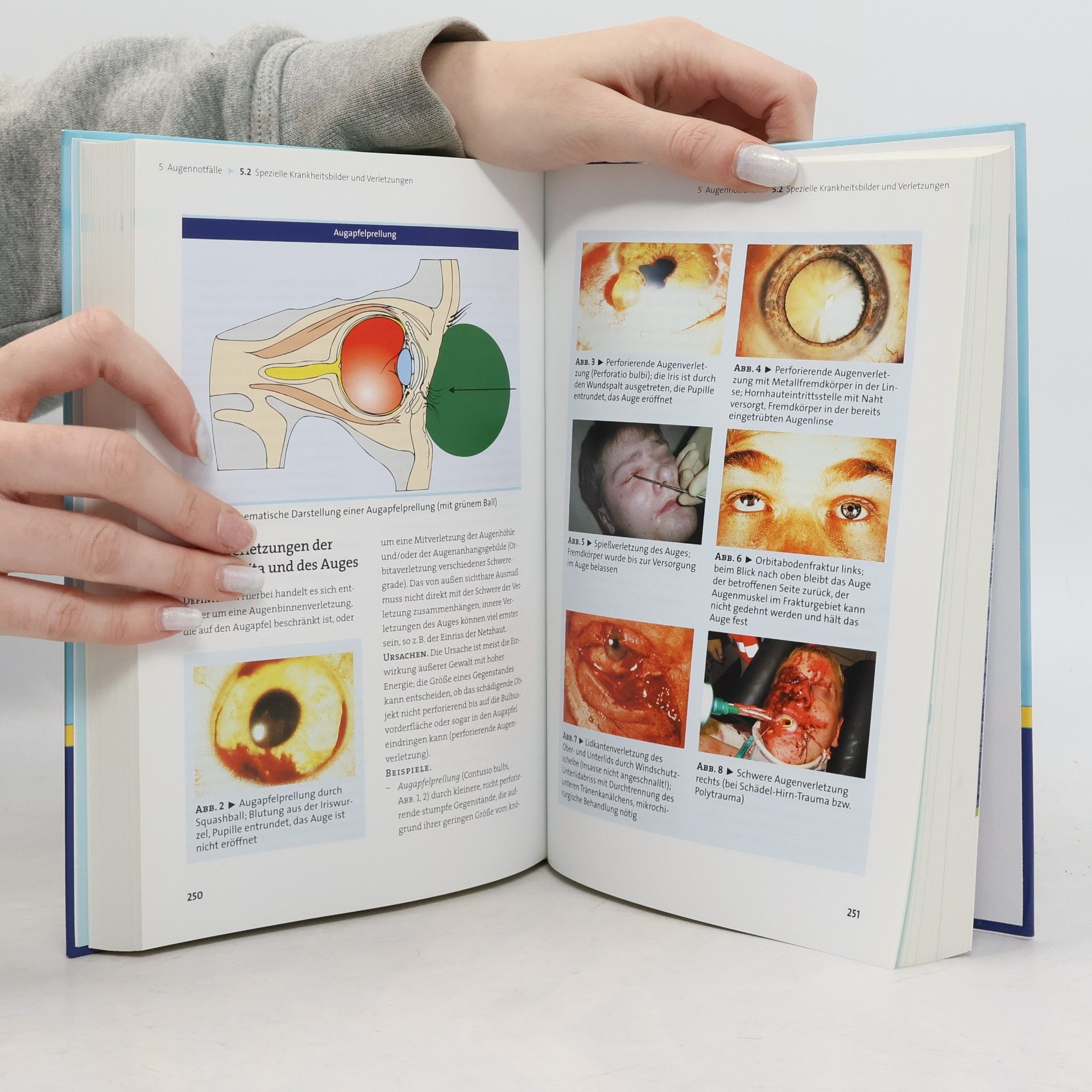Kersten Enke Lehrbuch für präklinische Notfallmedizin
