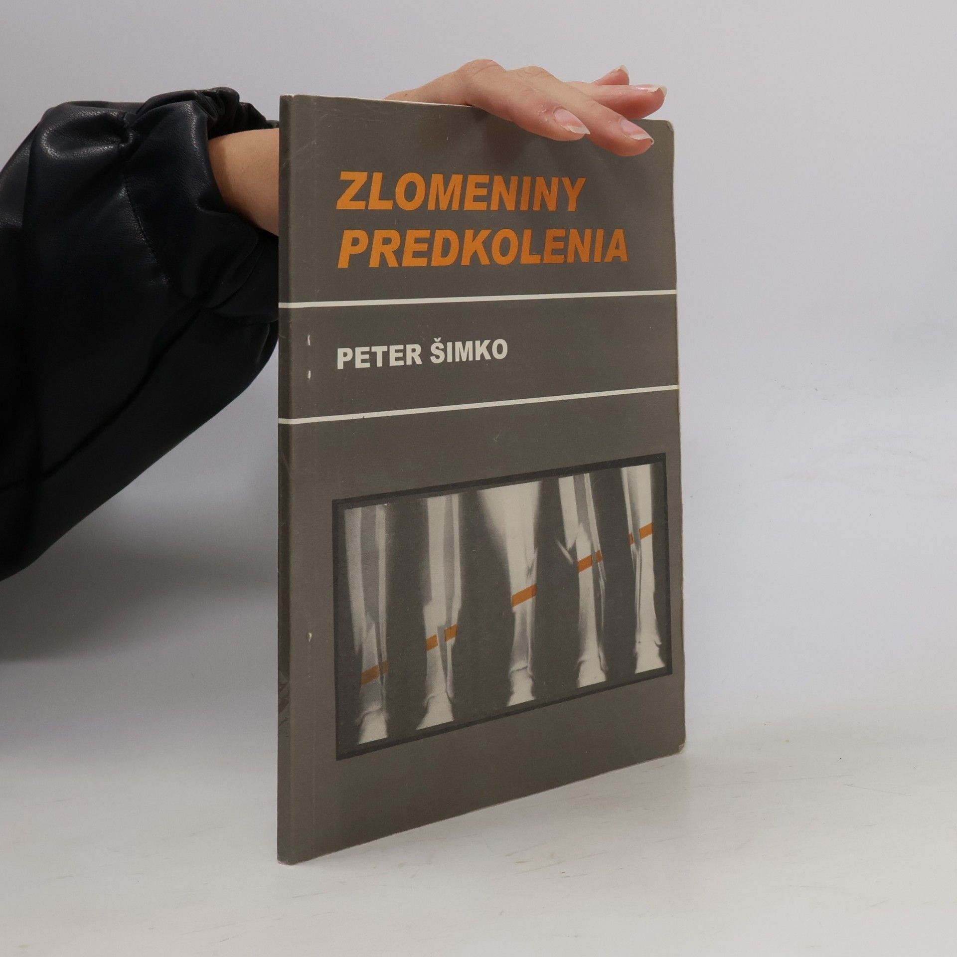 Peter Šimko ZLOMENINY PREDKOLENIA