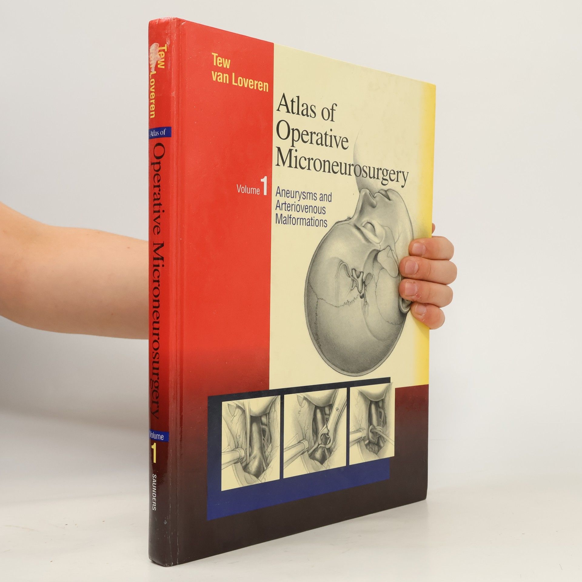 Atlas of Operative Microneurosurgery, Volume 1