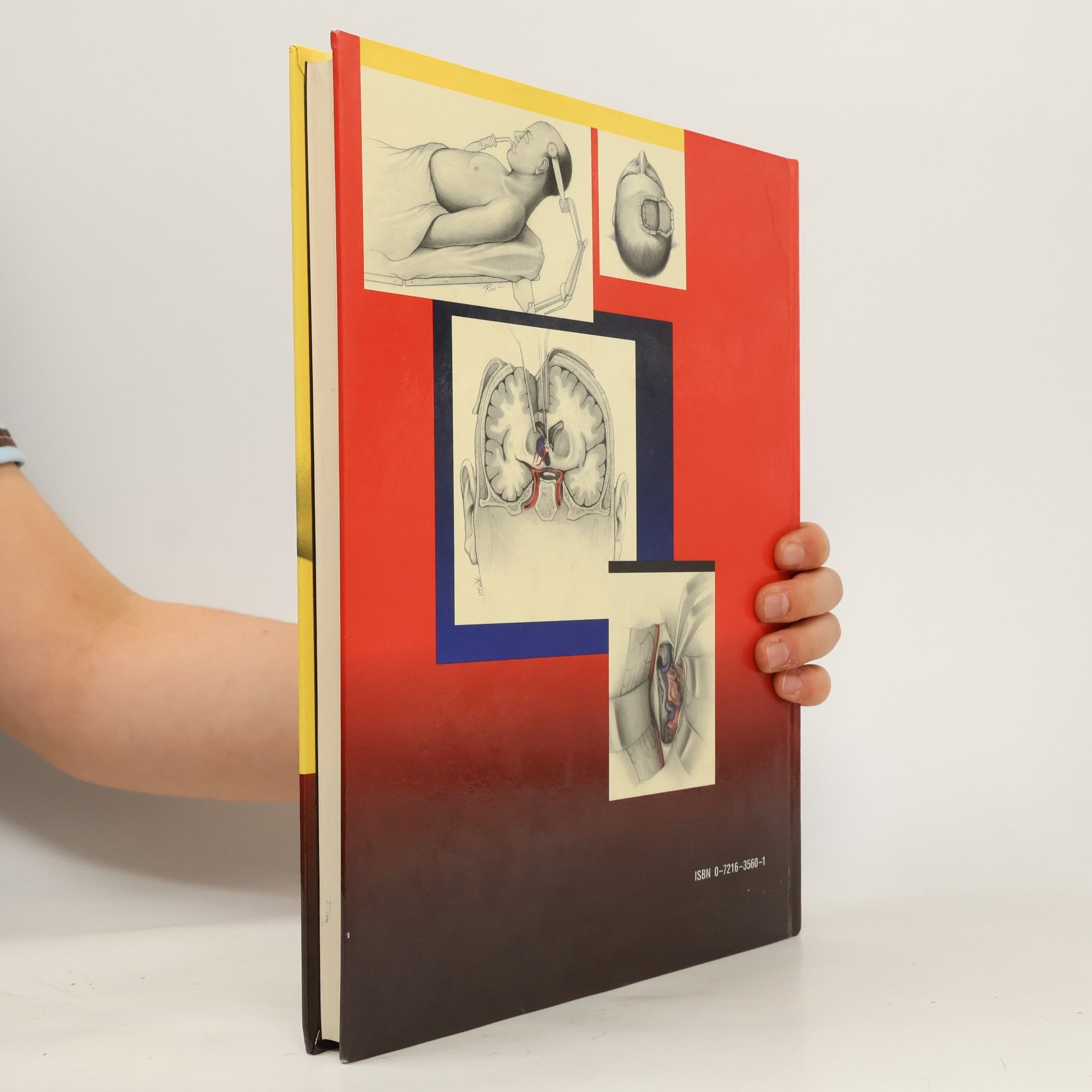 Van Loveren Atlas of Operative Microneurosurgery, Volume 1