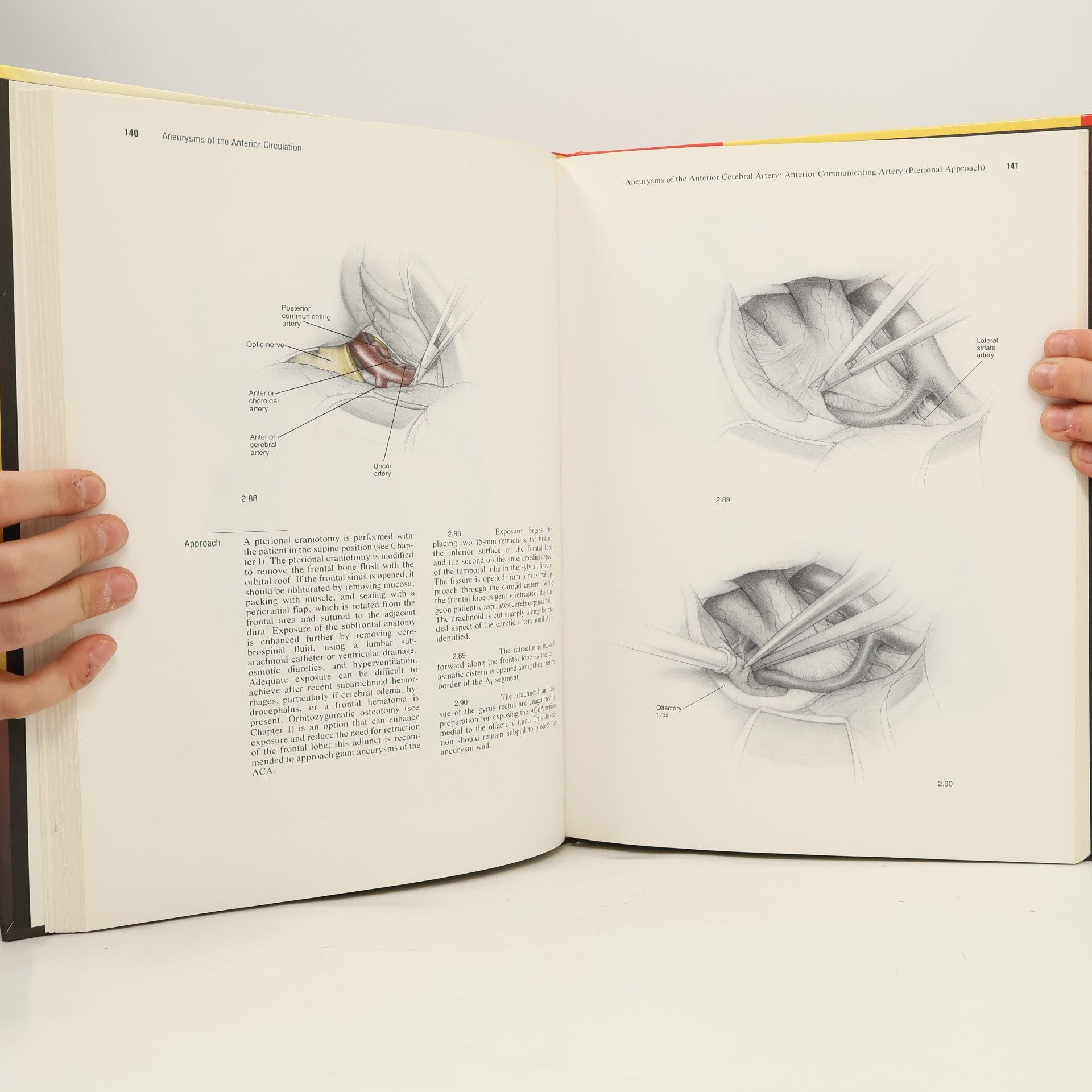 Van Loveren Atlas of Operative Microneurosurgery, Volume 1