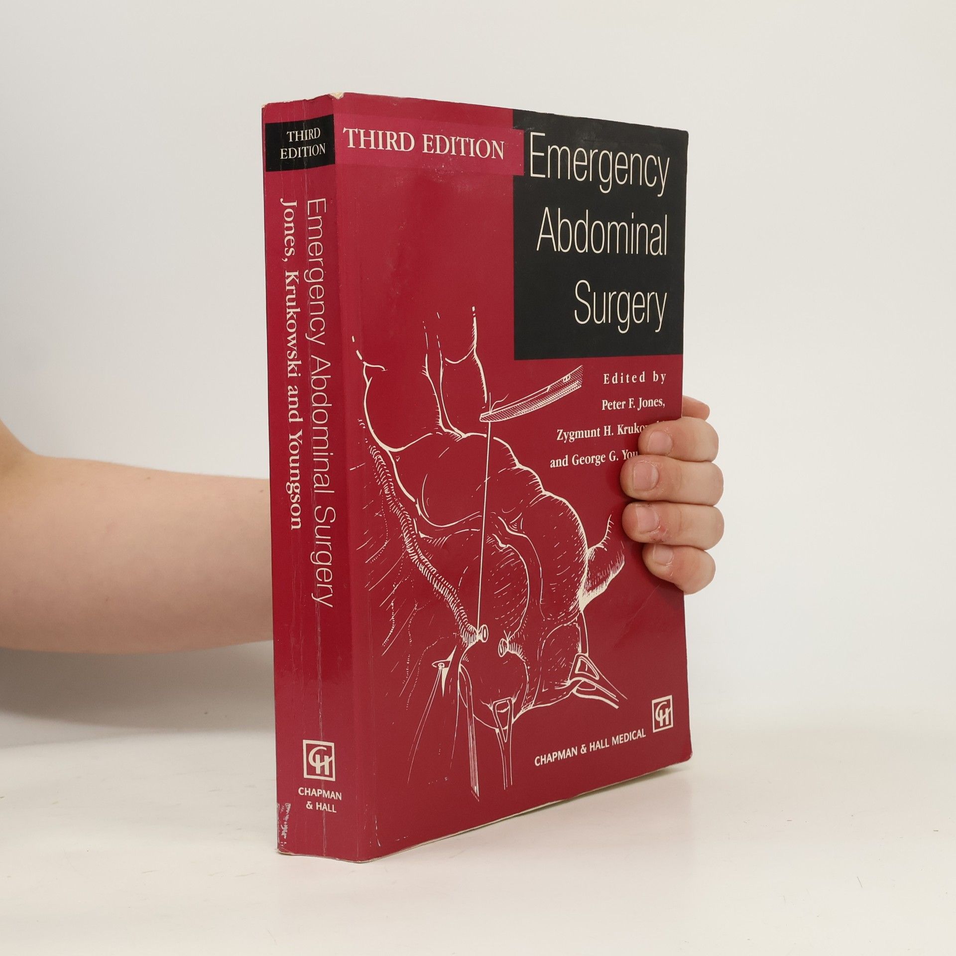 Emergency Abdominal Surgery
