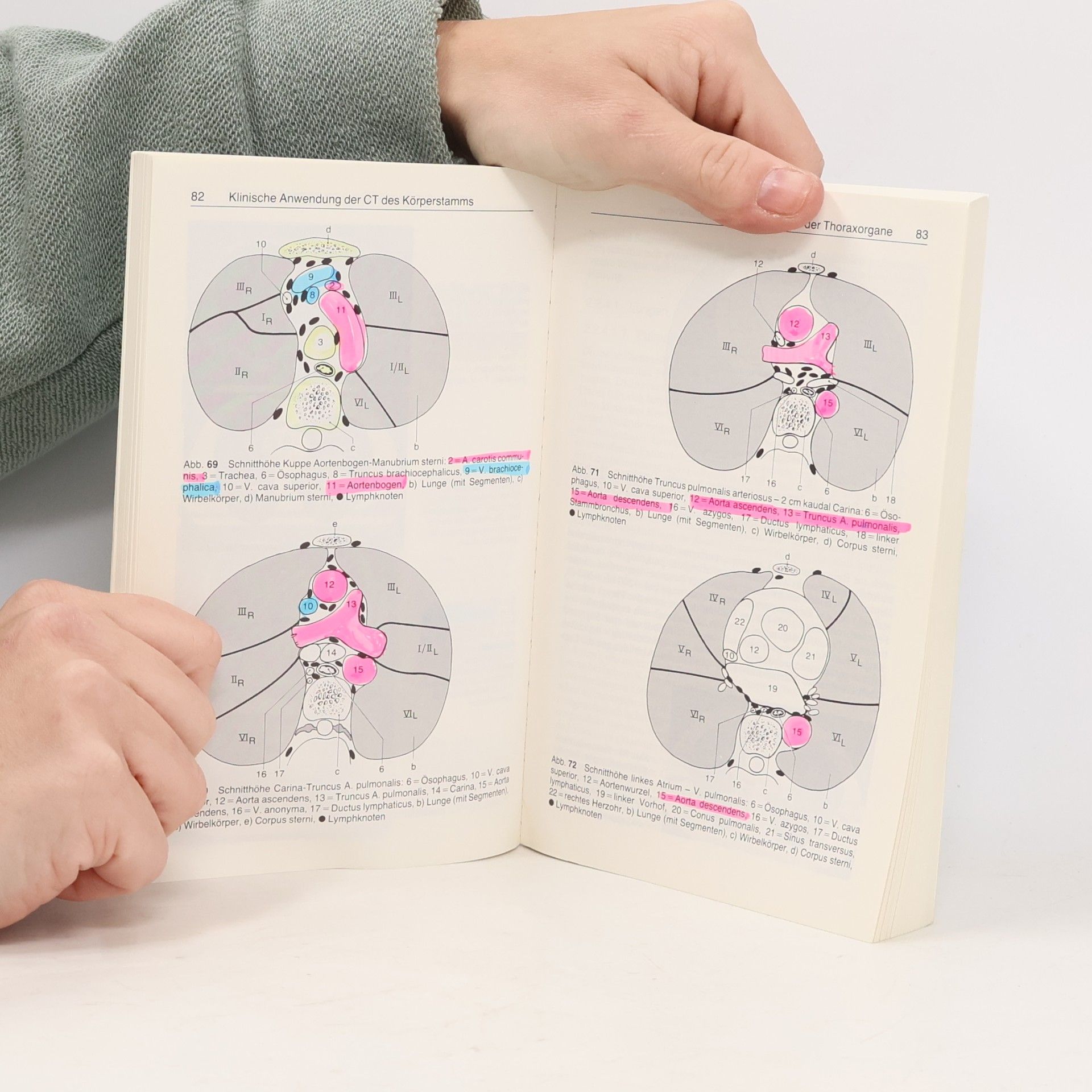 Klaus-Henning Hübener Röntgen - 6: Computertomographie des Körperstammes