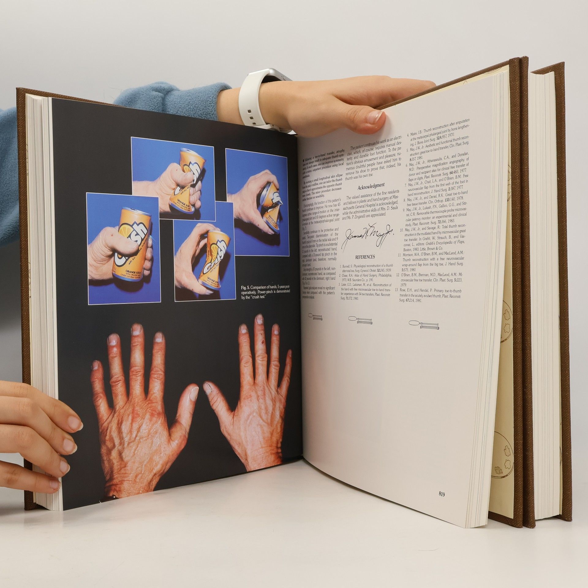 Burt Brent The Artistry of Reconstructive Surgery 1-2