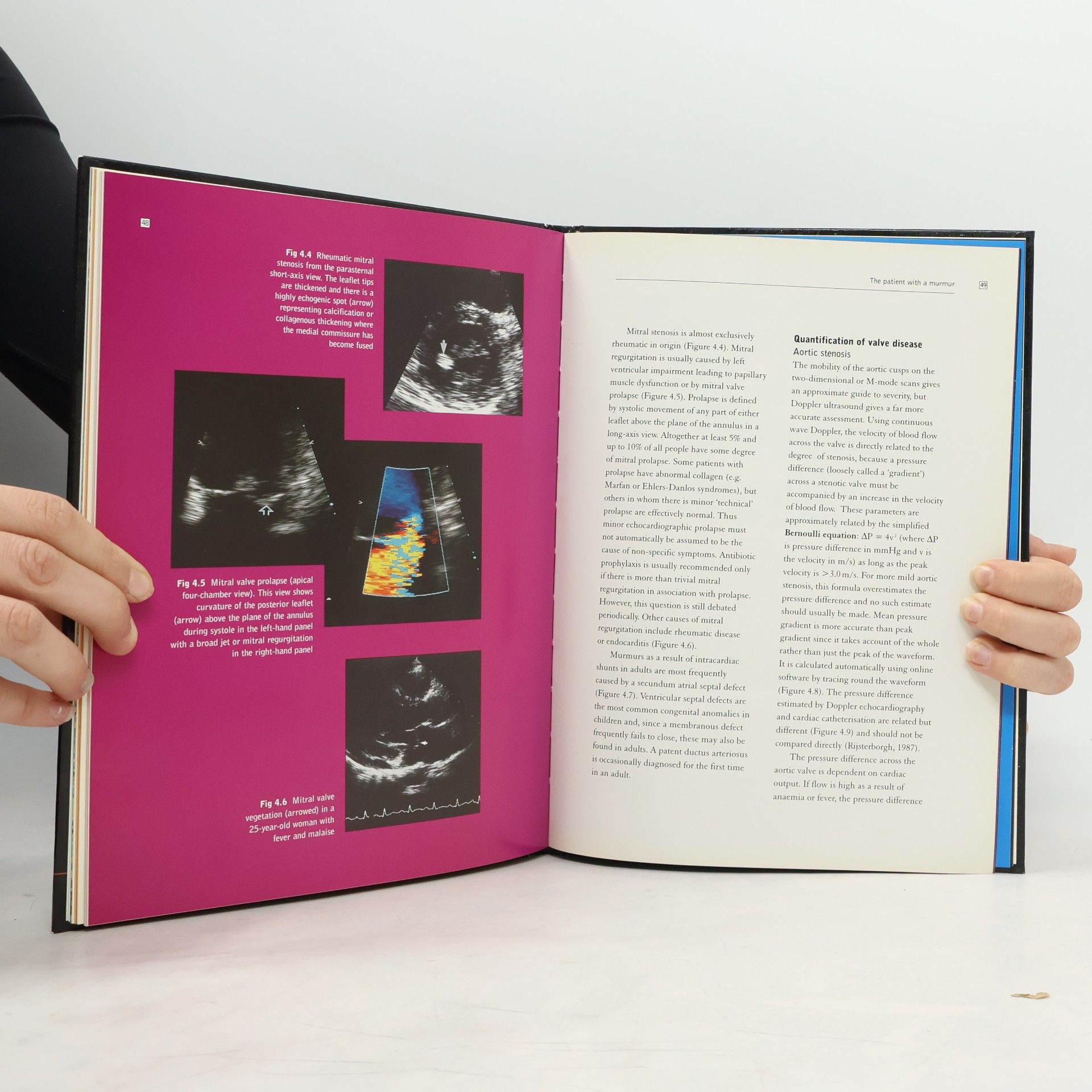 Dr John Chambers Echocardiography in Primary Care