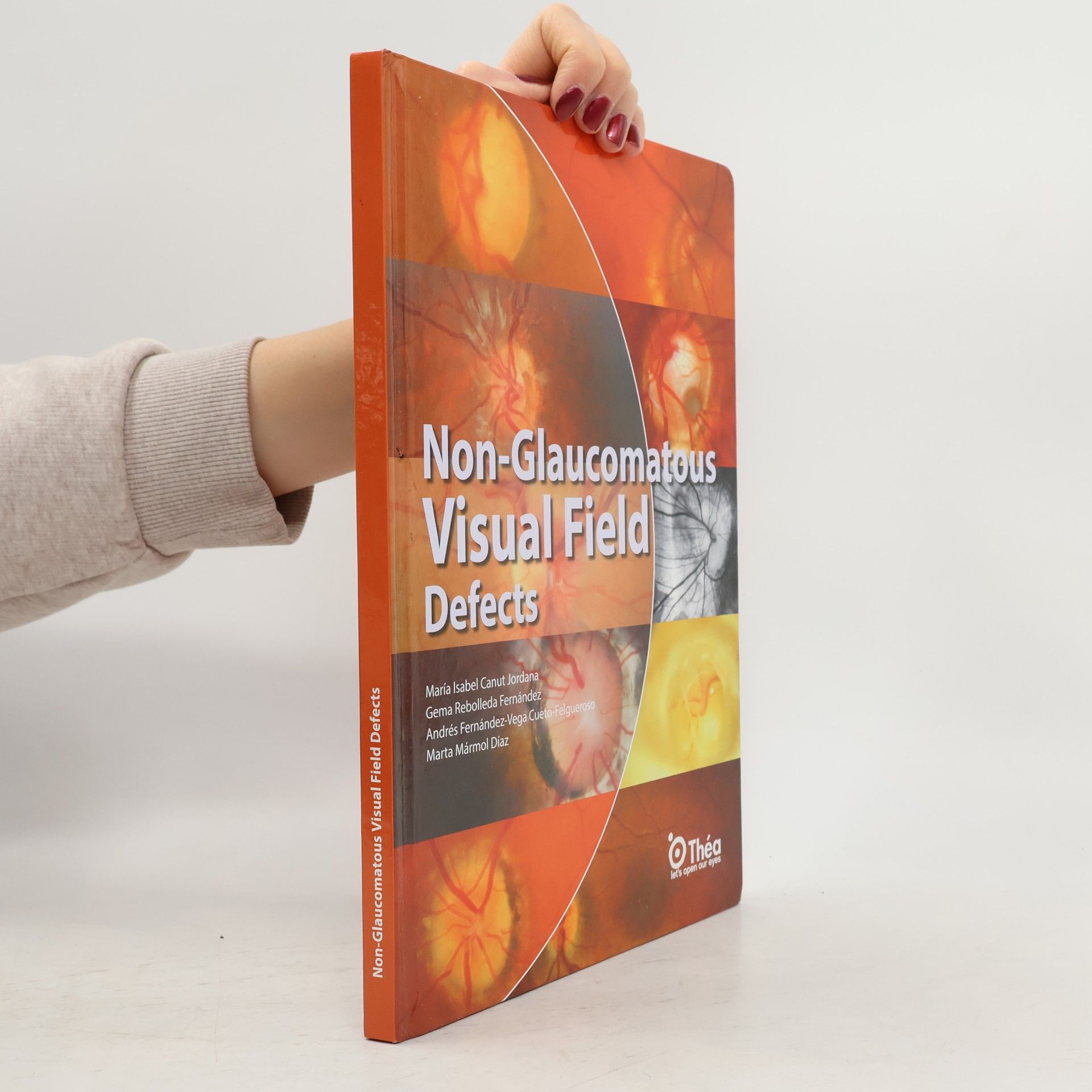 Autorenkollektiv Non-Glaucomatous Visual Field Defects