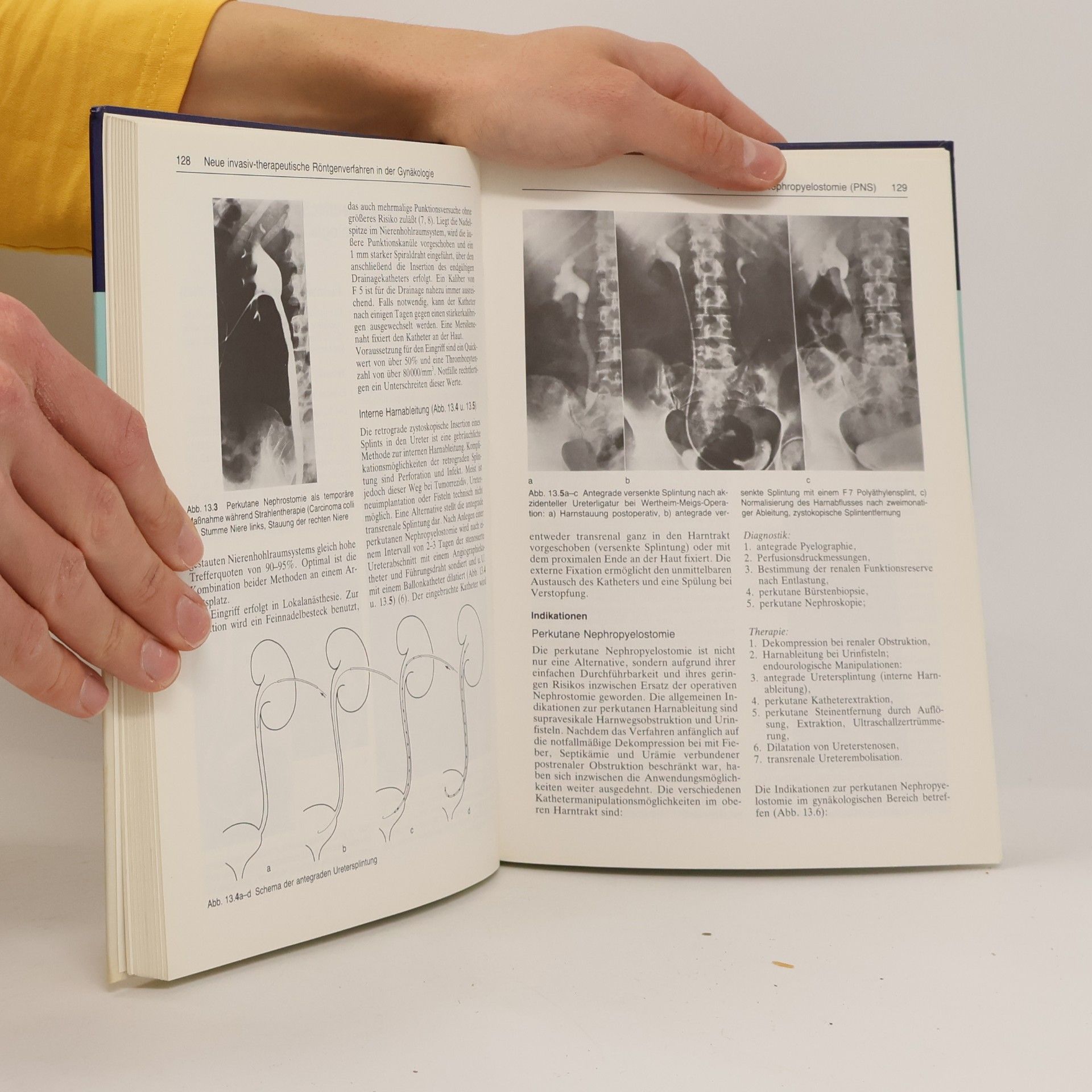 R. Hohenfellner Gynäkologische Urologie
