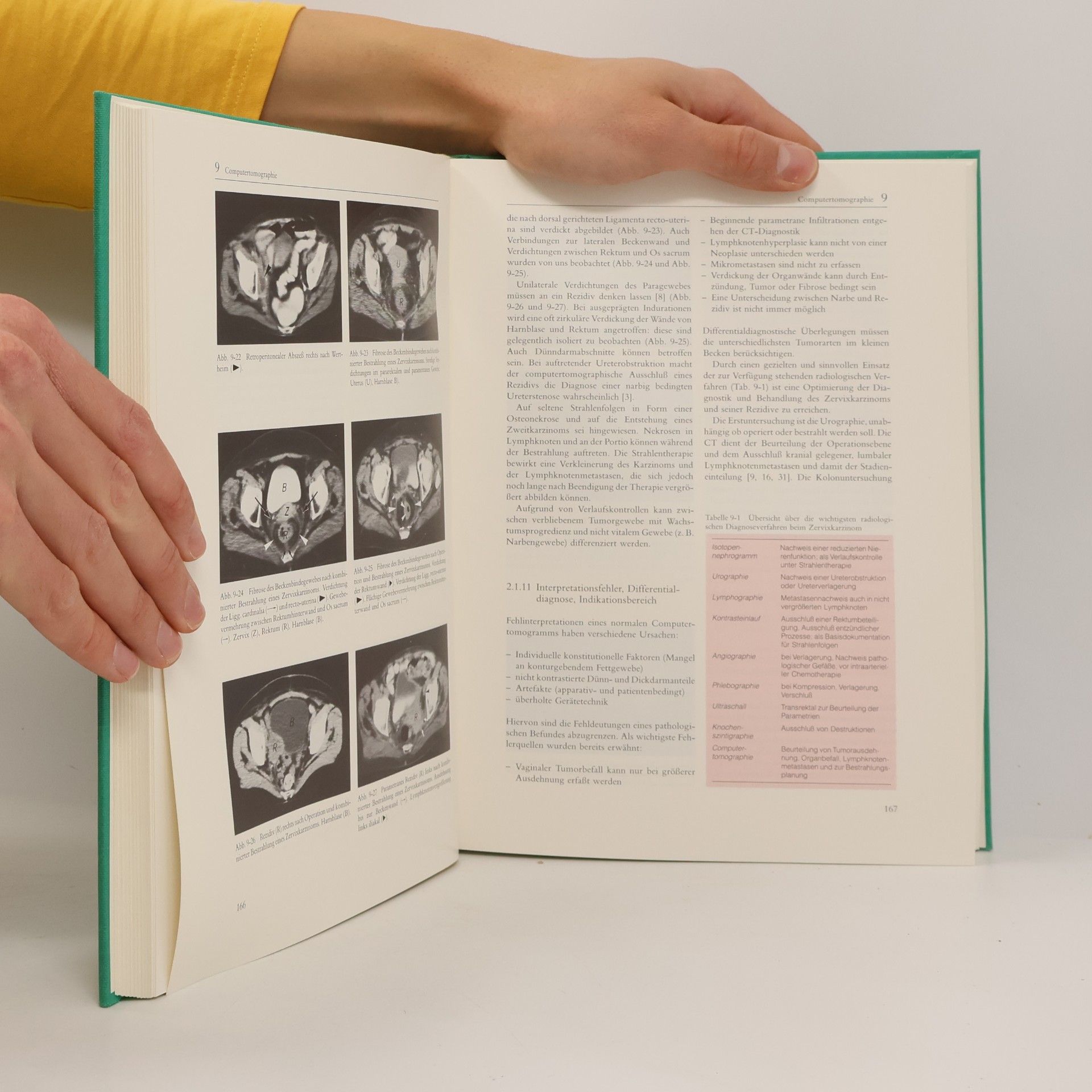 Wolf-Heinrich Schmidt Klinik der Frauenheilkunde und Geburtshilfe - 10: Allgemeine gynäkologische Onkologie