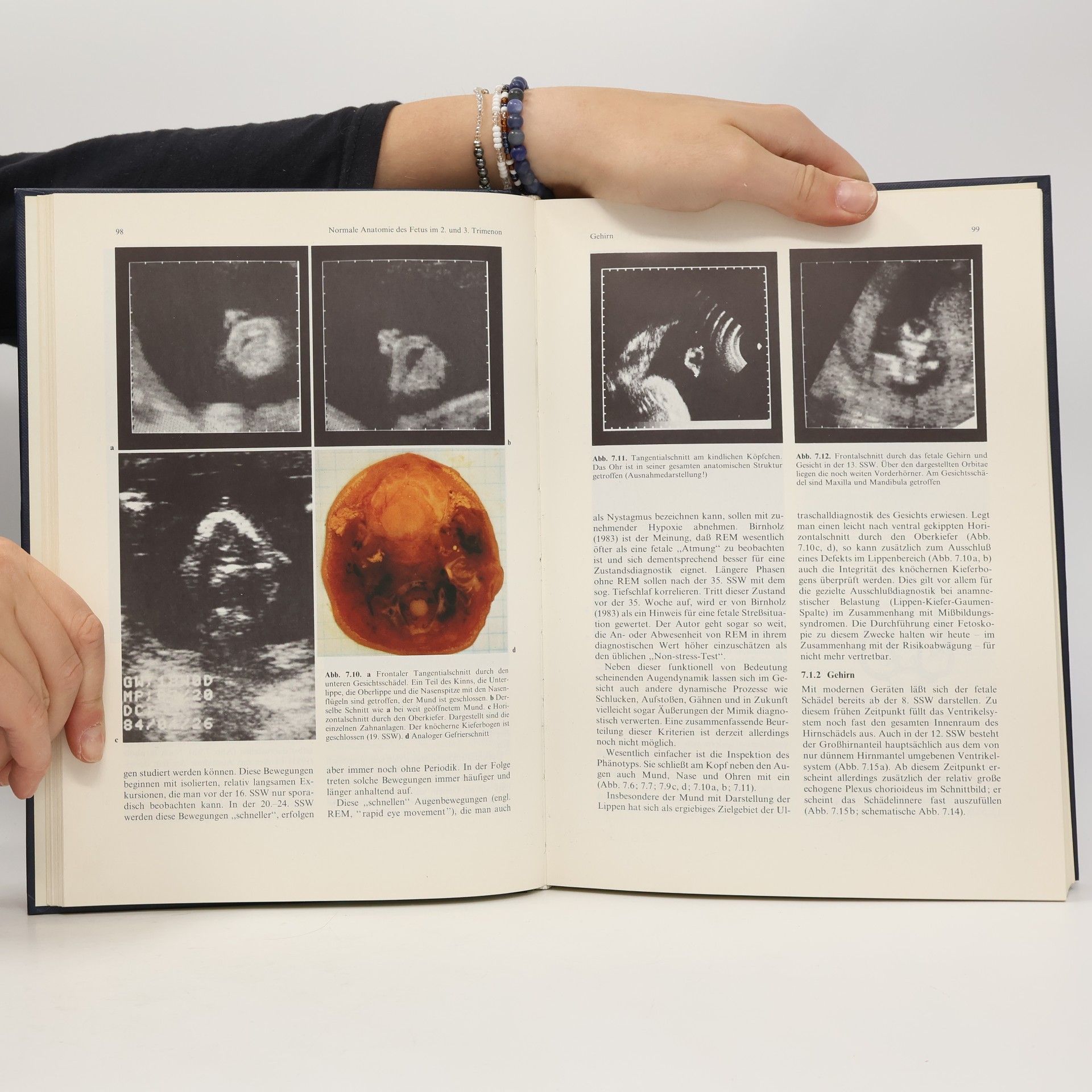 Manfred Hansmann Ultraschalldiagnostik in Geburtshilfe und Gynäkologie