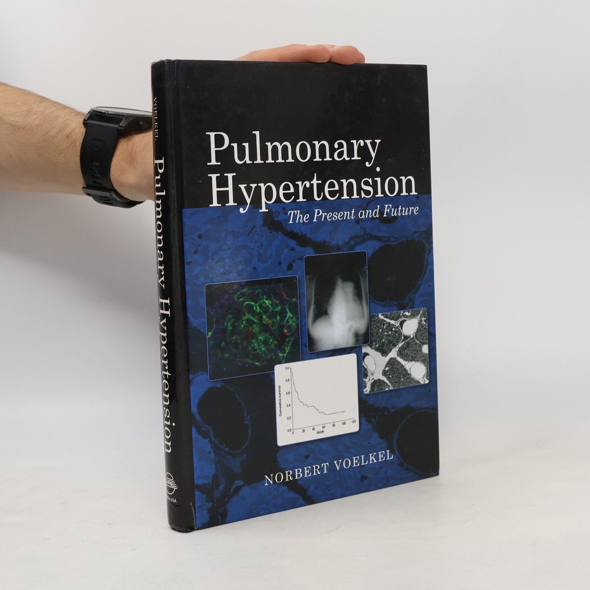 Norbert F. Voelkel Pulmonary Hypertension