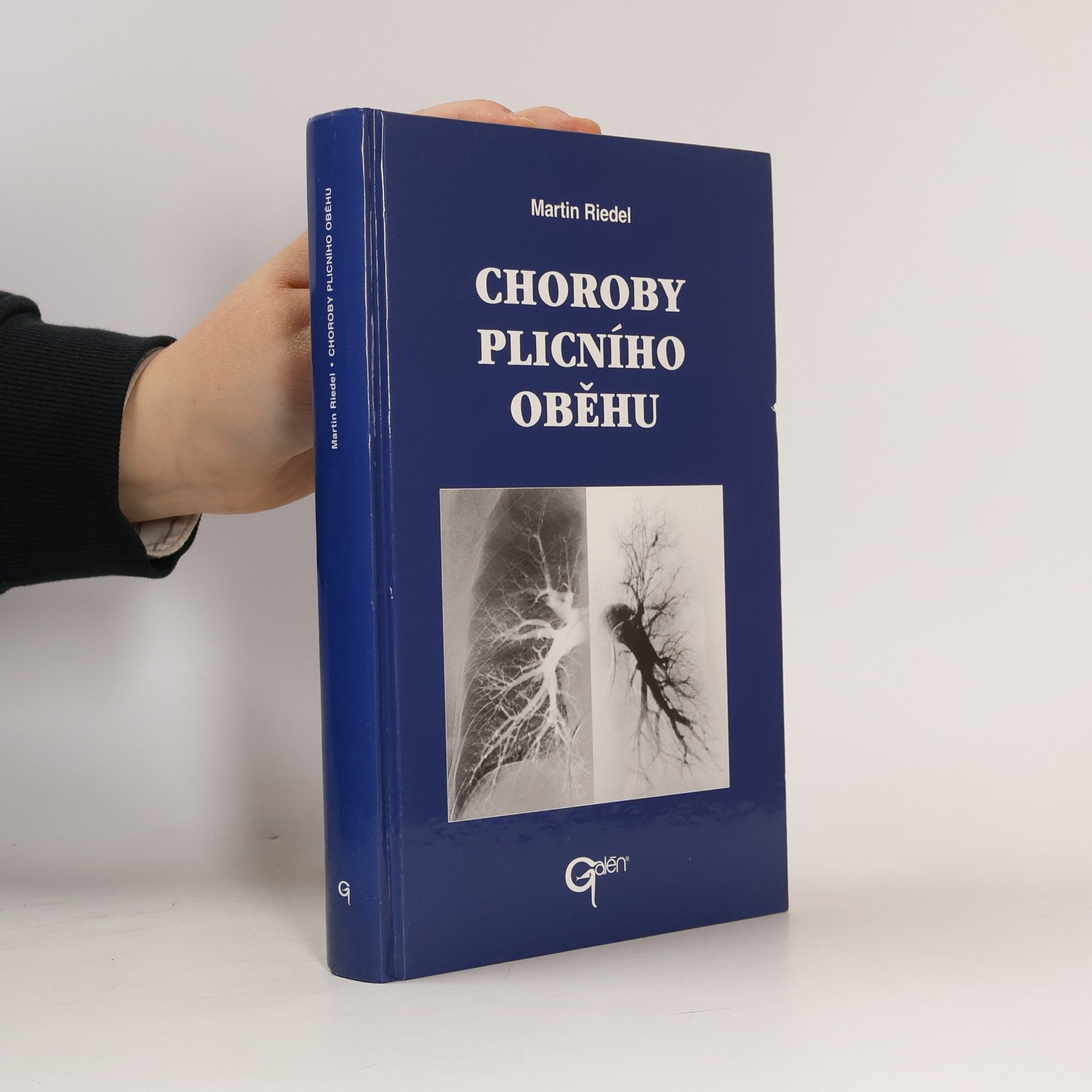 Martin Riedel Choroby plicního oběhu