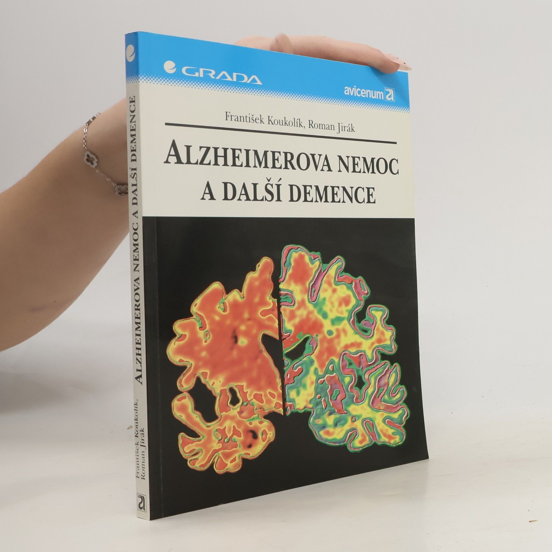 Alzheimerova nemoc a další demence