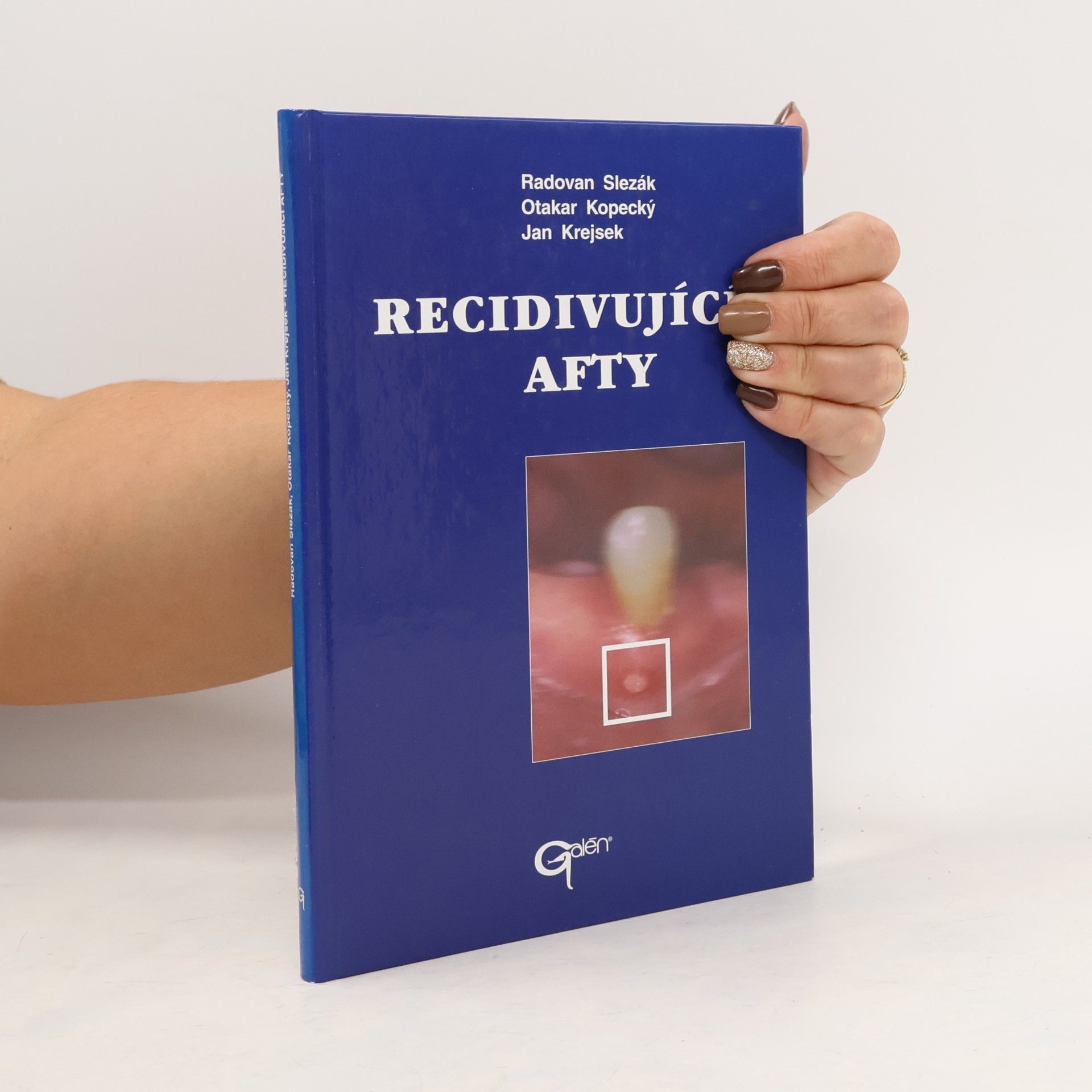 Recidivující afty