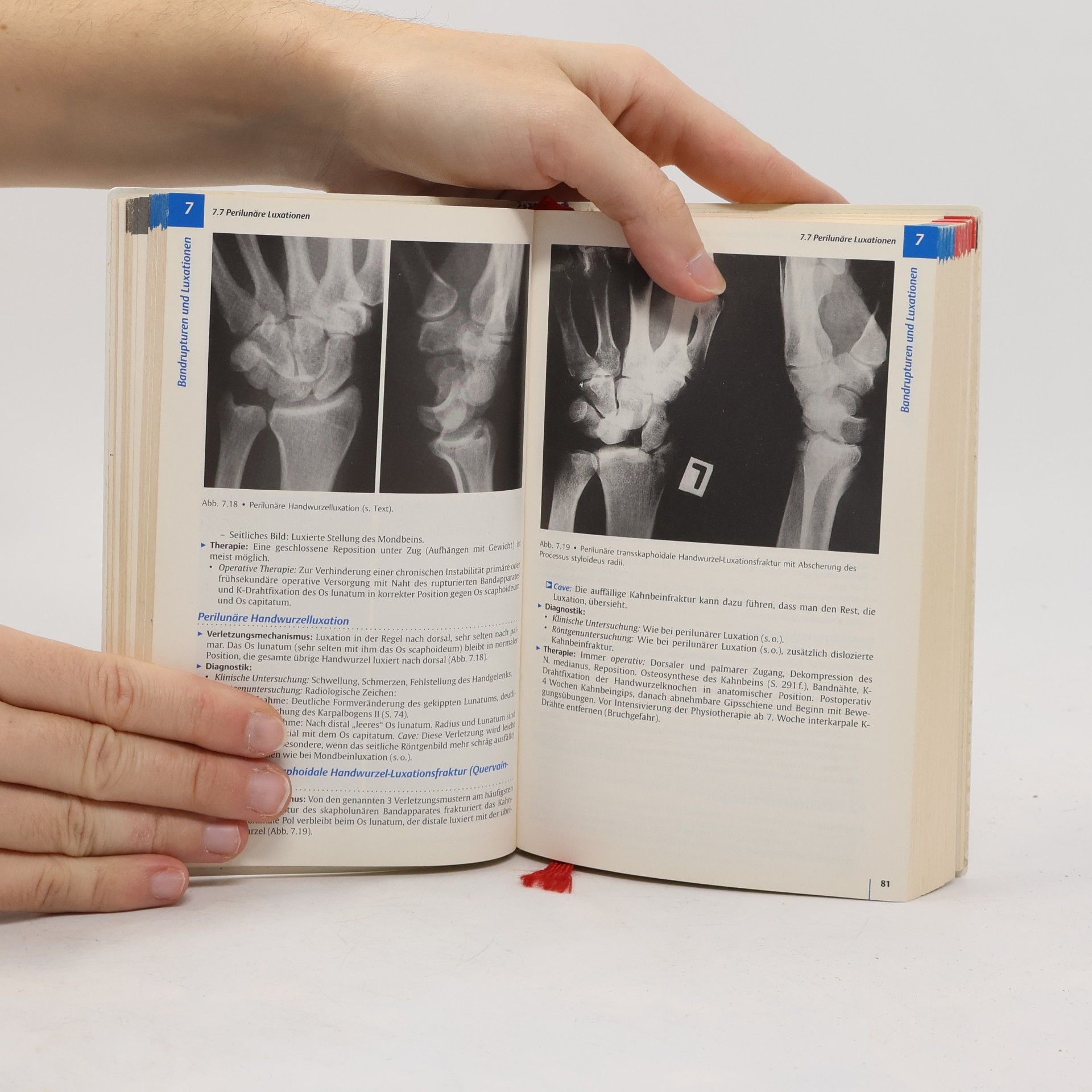 Ellinor Haase Checkliste Handchirurgie: 3. Auflage