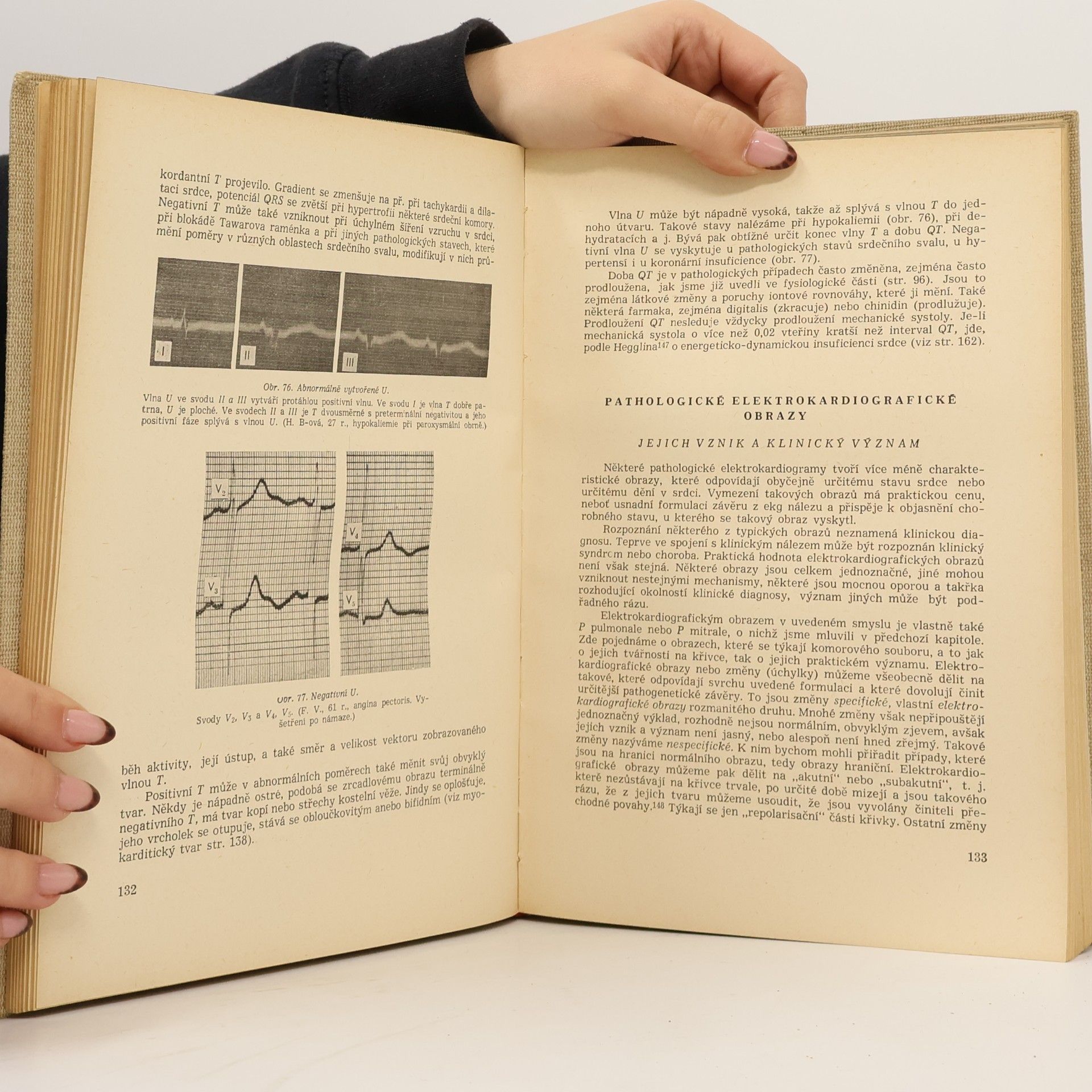 František Herles Základy elektrokardiografie