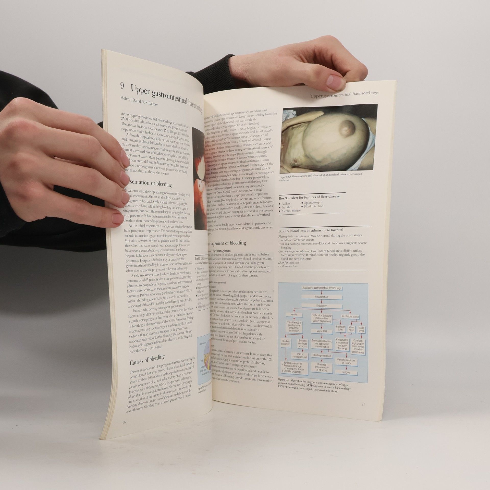 Adam Harris ABC of the Upper Gastrointestinal Tract