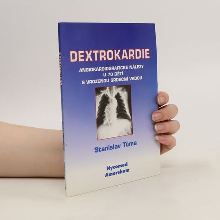 Dextrokardie: Angiokardiografické nálezy u 70 dětí s vrozenou srdeční vadou