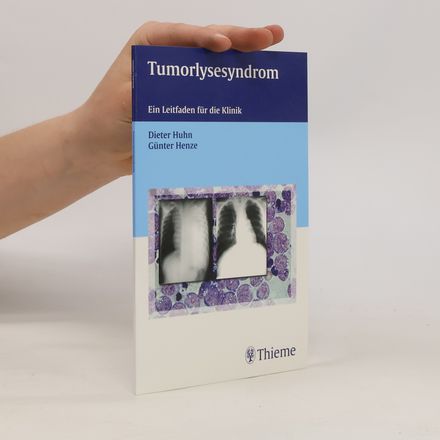 Tumorlysesyndrom