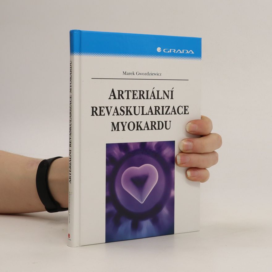 Marek Gwozdziewicz Arteriální revaskularizace myokardu