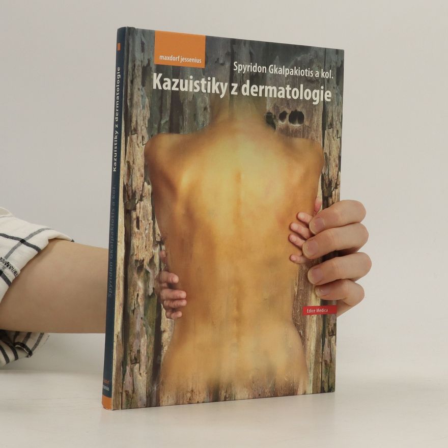 Spyridon Gkalpakiotis Kazuistiky z dermatologie
