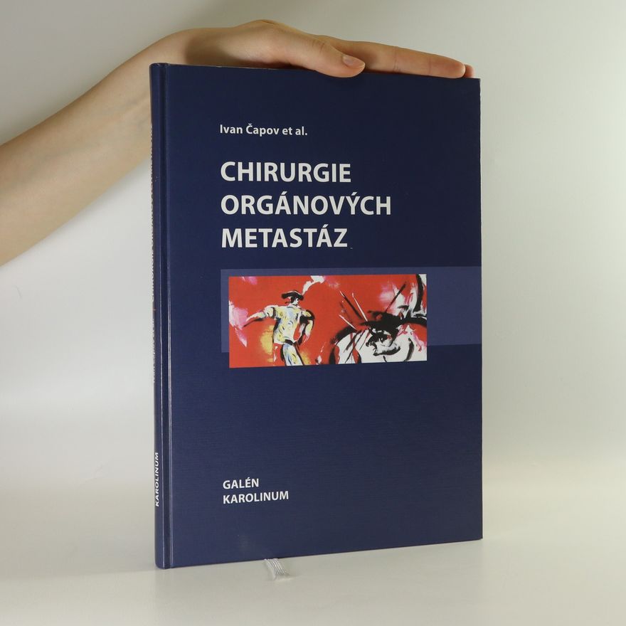 Ivan Čapov Chirurgie orgánových metastáz