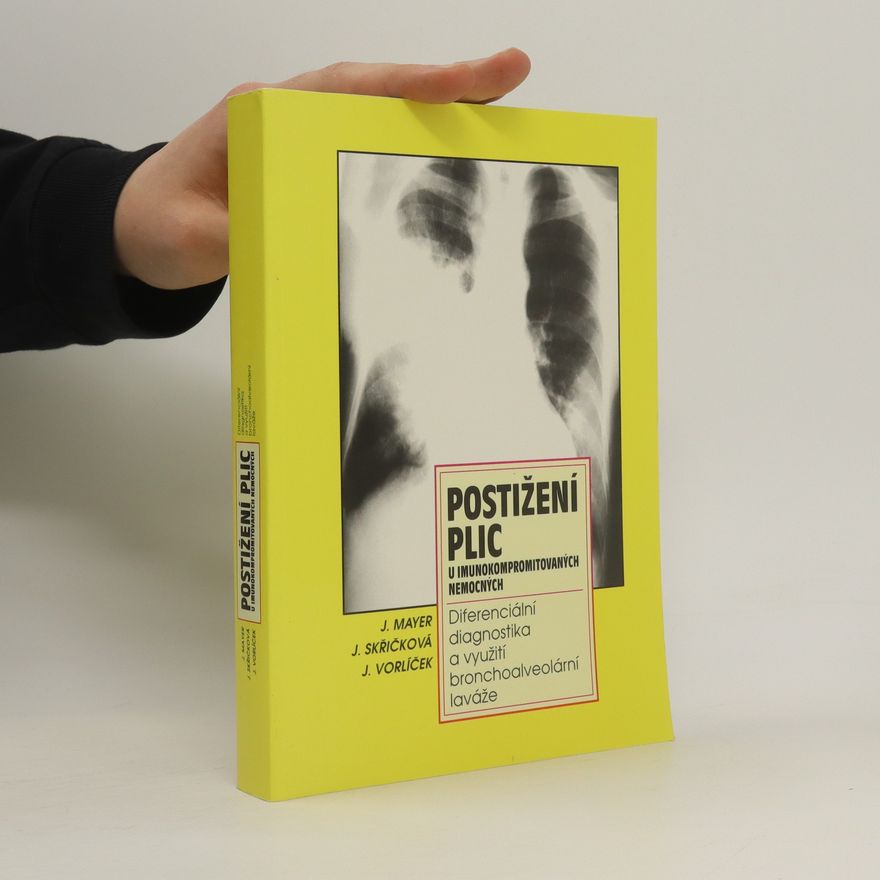 Jiří Vorlíček Postižení plic u imunokompromitovaných nemocných : diferenciální diagnostika a využití bronchoalveolární laváže