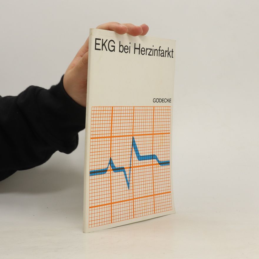 Autorenkollektiv EKG bei Herzinfarkt