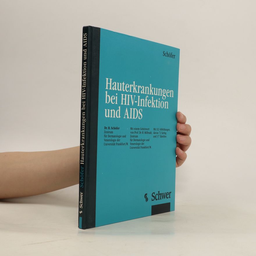 Helmut Schöfer Hauterkrankungen bei HIV-Infektion und AIDS