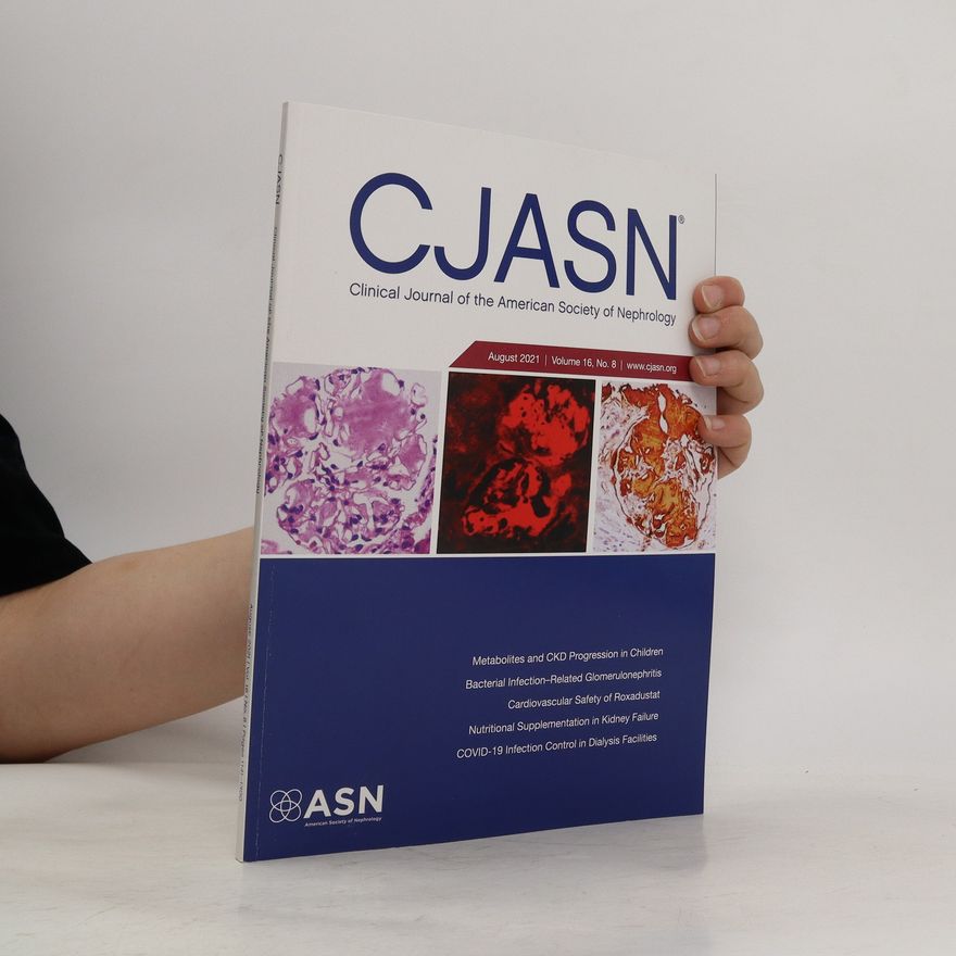 Autorenkollektiv Clinical journal of the American Society of Nephrology CJASN 8/2021