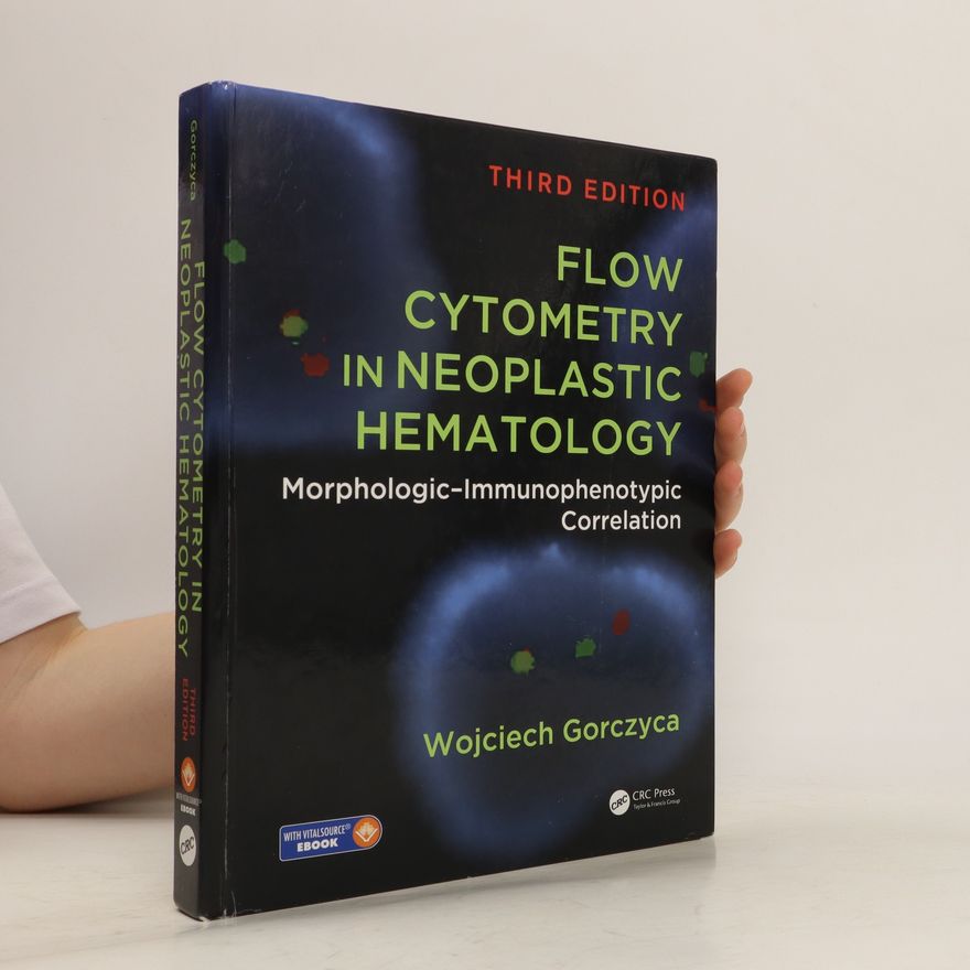 Wojciech Gorczyca Flow Cytometry in Neoplastic Hematology