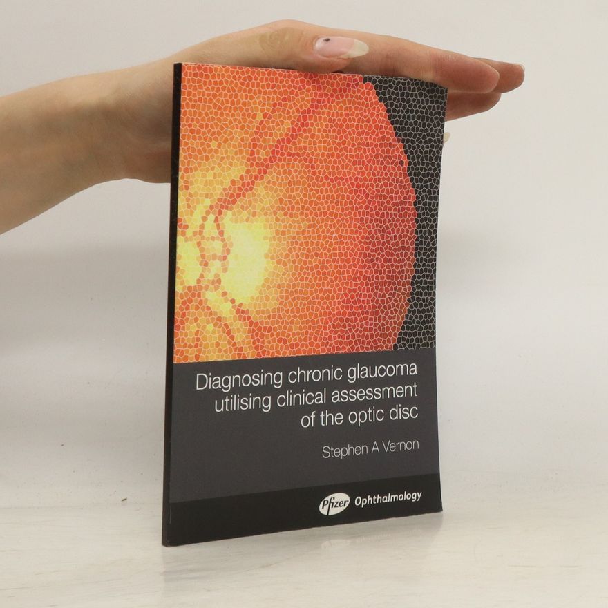 Stephen A. Vernon Diagnosing Chronic Glaucoma Utilising Clinical Assessment of the Optic Disc