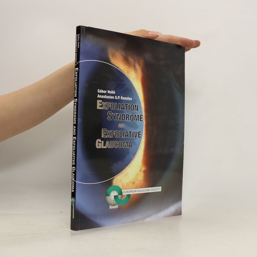 Anastasios G.P. Konstas Exfoliation Syndrome and Exfoliative Glaucoma