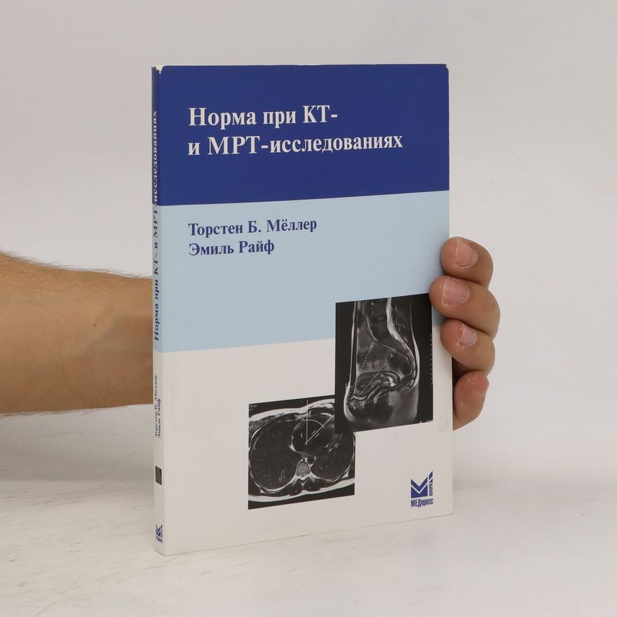 Autorenkollektiv Норма при КТ- и МРТ- исследованиях. Norma pri KT- i MRT- issledovaniyakh.