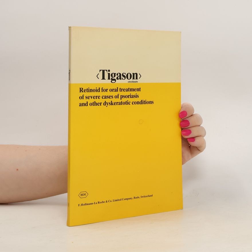 Autorenkollektiv Tigason. Retinoid for Oral Treatment of Severe Cases of Psoriasis and Other Dyskeratotic Conditions