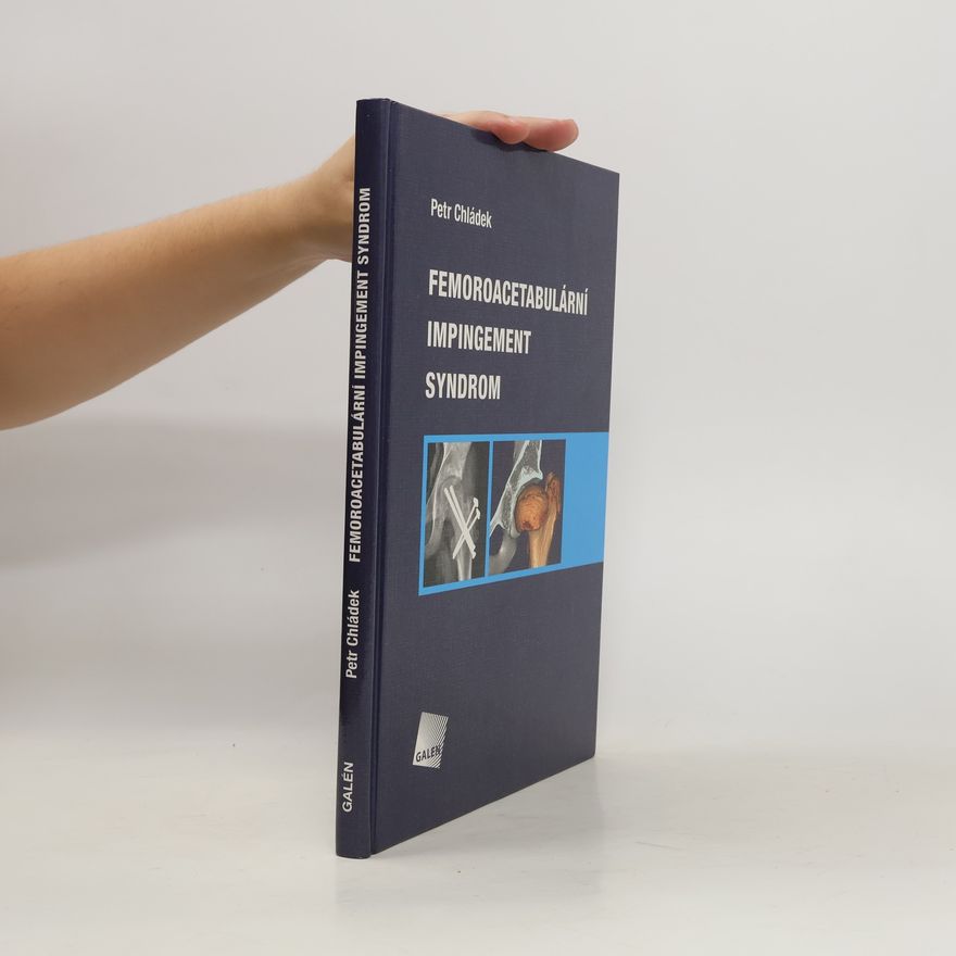 Petr Chládek Femoroacetabulární impingement syndrom