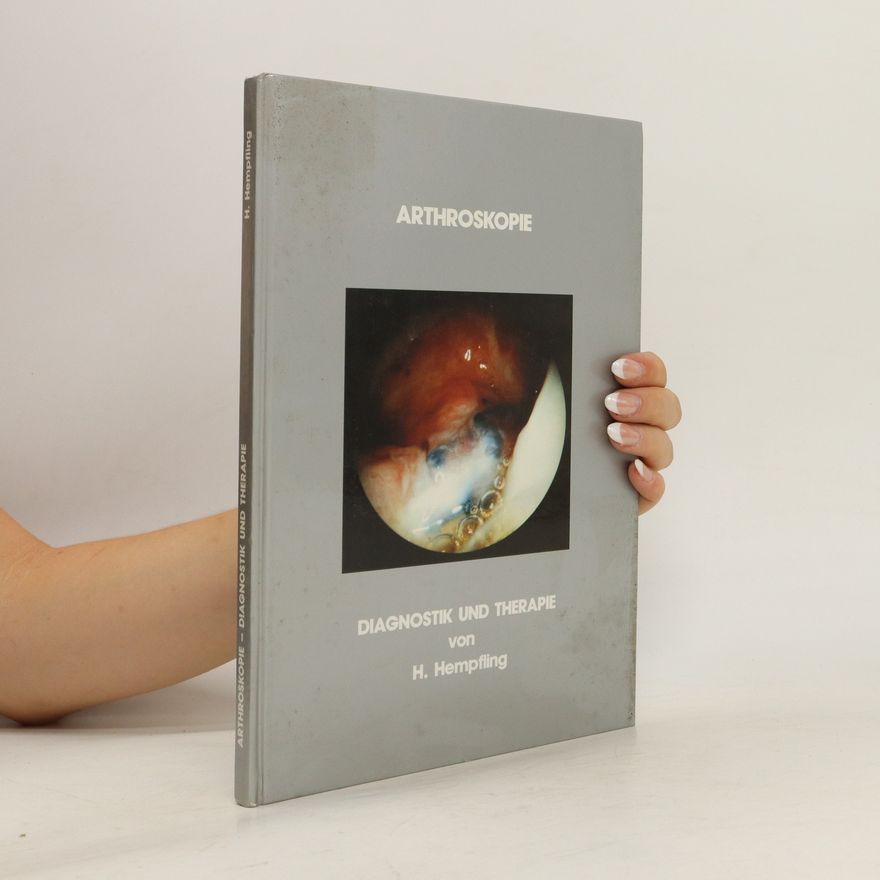 Harald Hempfling Arthroskopie. Diagnostik und Therapie