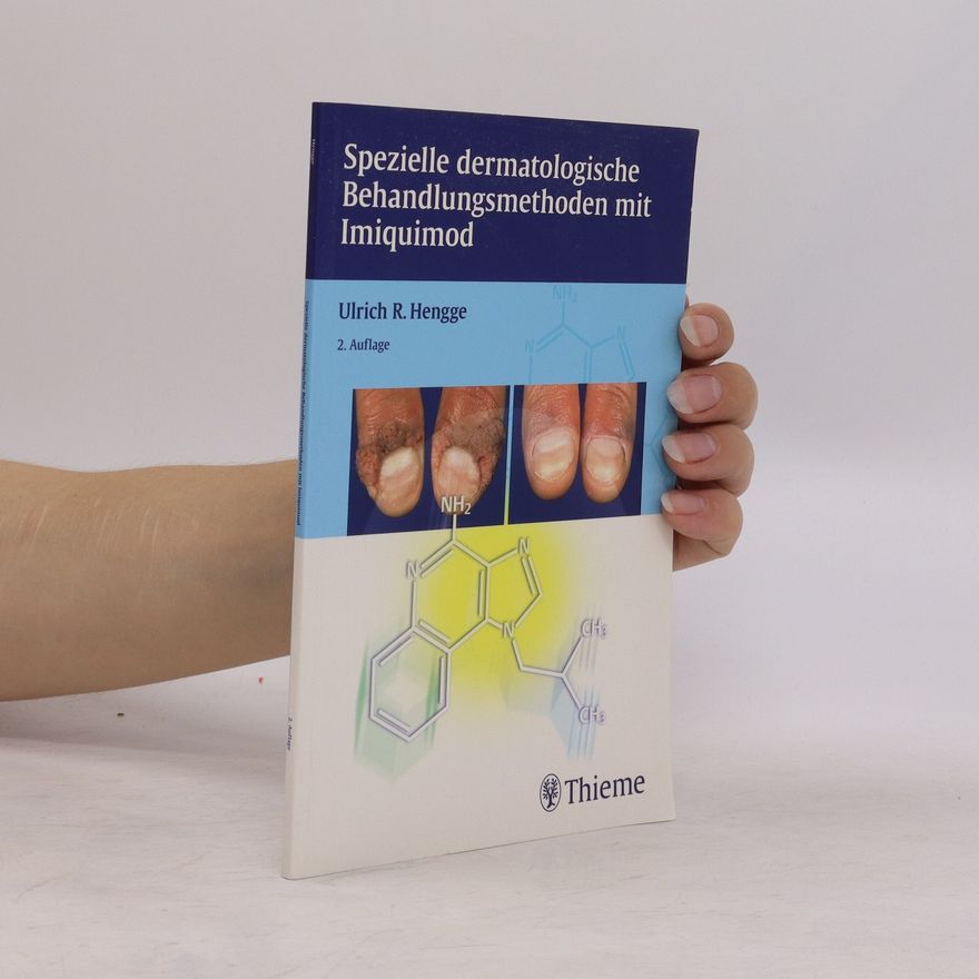 Ulrich R. Hengge Spezielle dermatologische Behandlungsoptionen mit Imiquimod