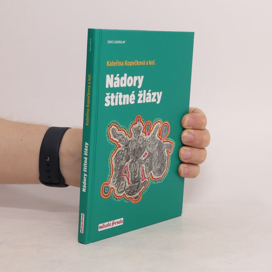 Kateřina Kopečková Nádory štítné žlázy