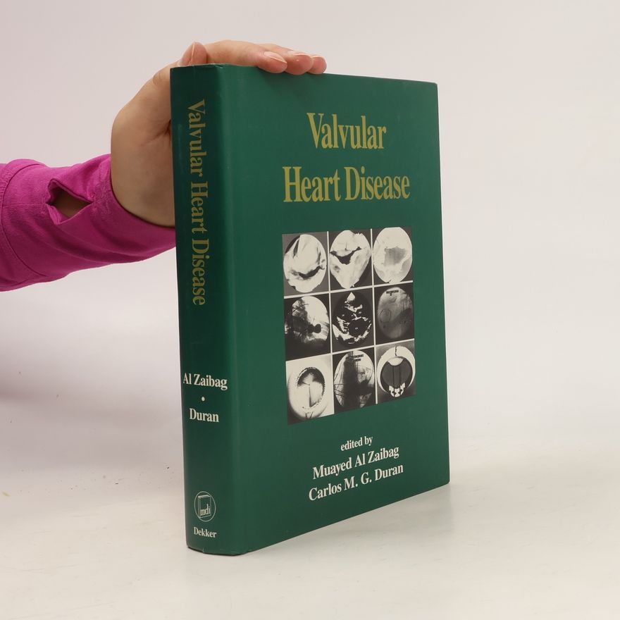 Carlos Gomez-Duran Valvular Heart Disease