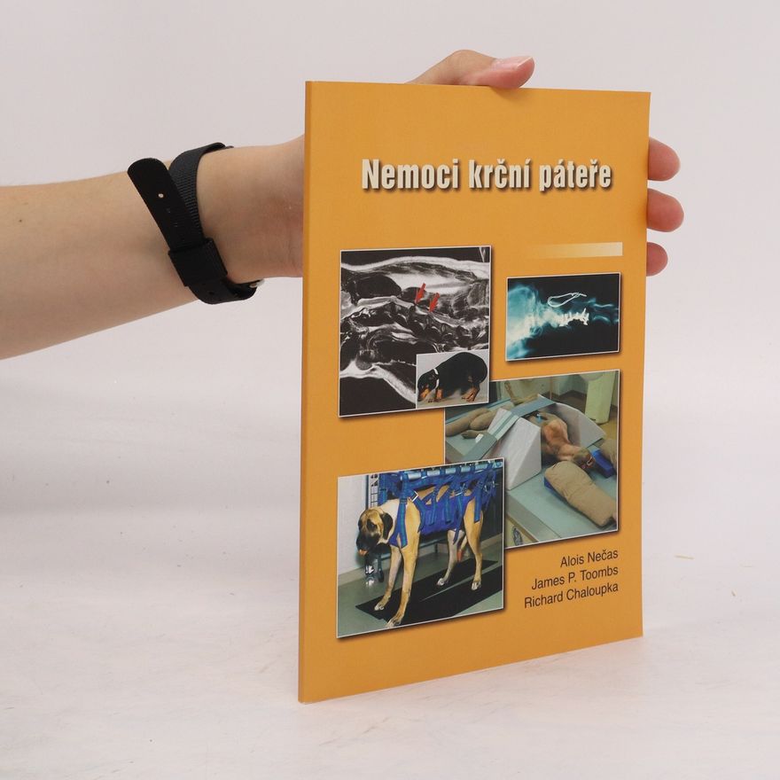 James P. Toombs Nemoci krční páteře