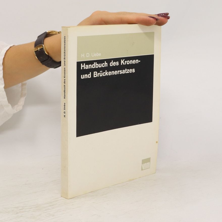 Hans Dieter Uebe Handbuch des Kronen- und Brückenersatzes