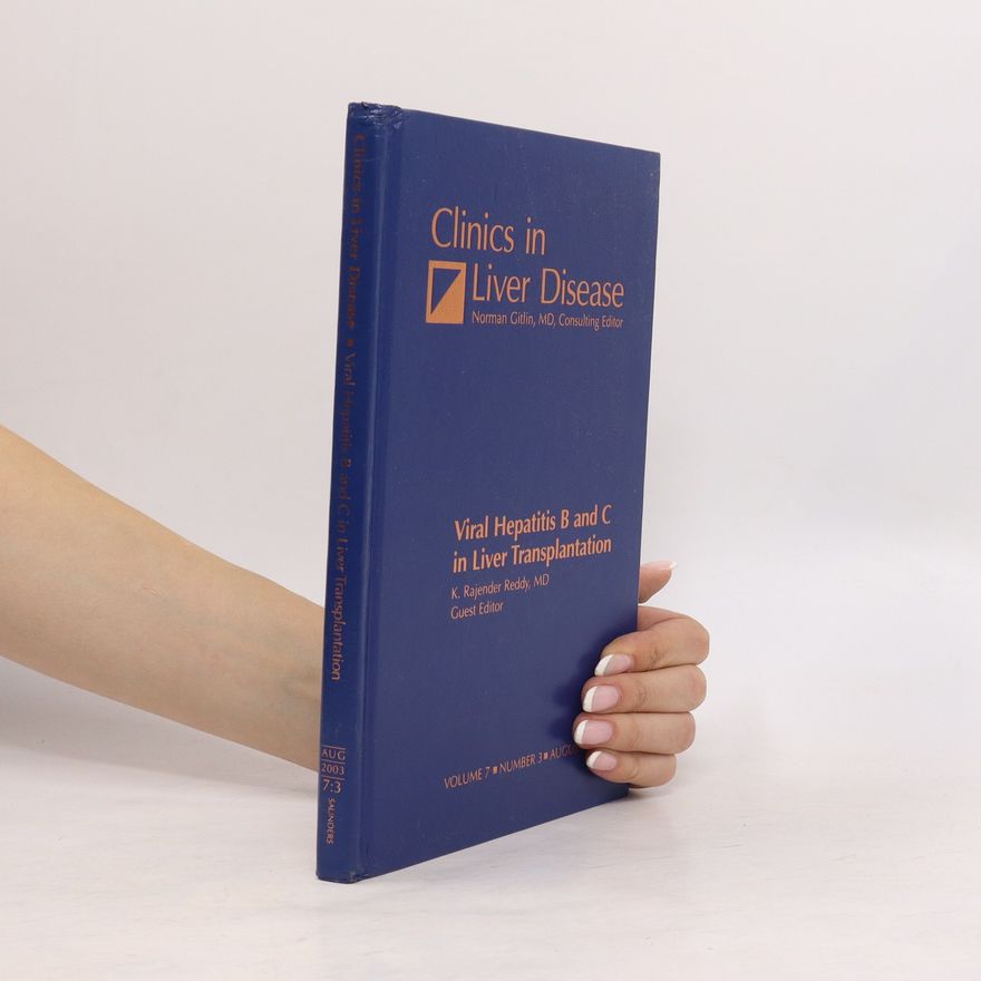 Kolektiv autorů Clinics in Liver Disease 2/1988. Metabolic Liver Disease 2/1