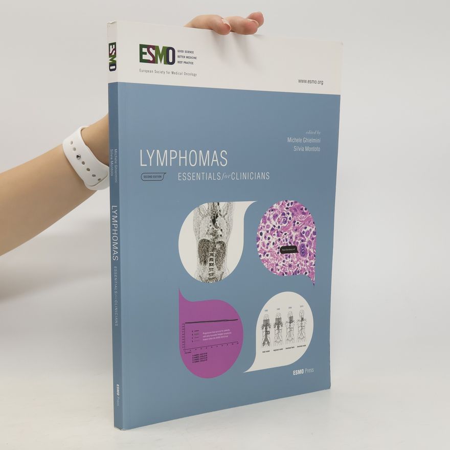 Michele Ghielmini Lymphomas