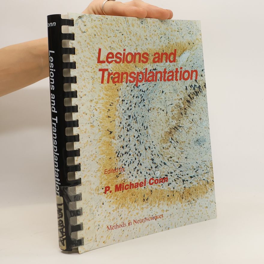 P. Michael Conn Lesions and Transplantation